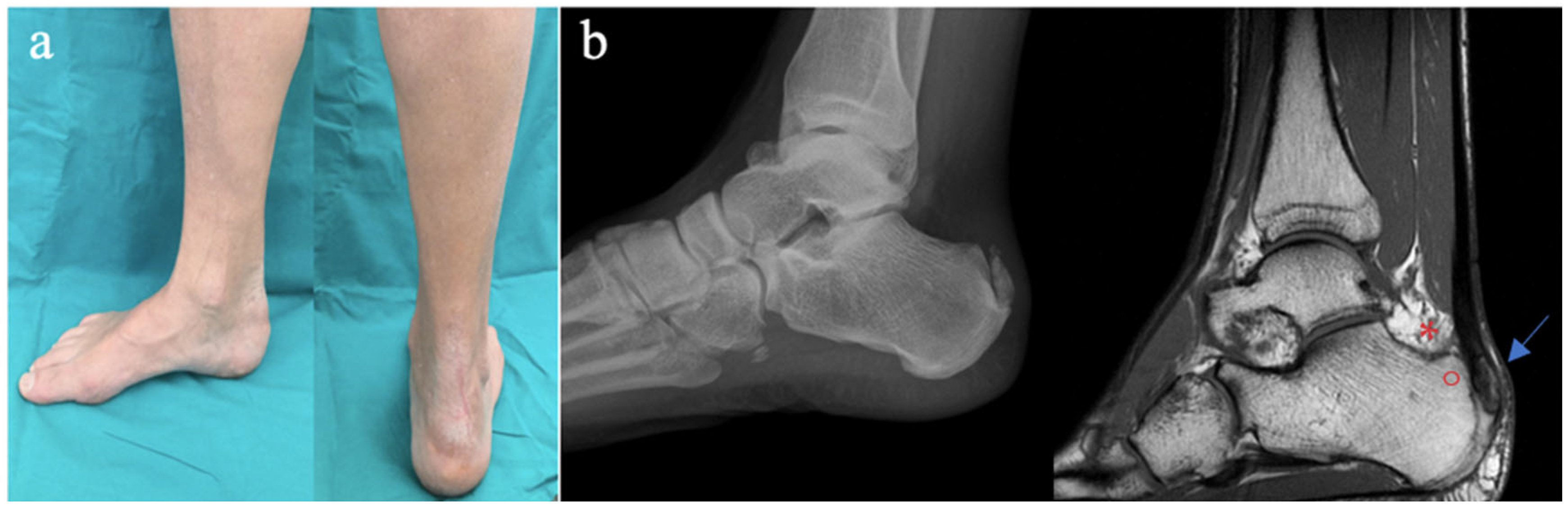 Medicina 61 01445 g001 Medicina 61 01445 g001