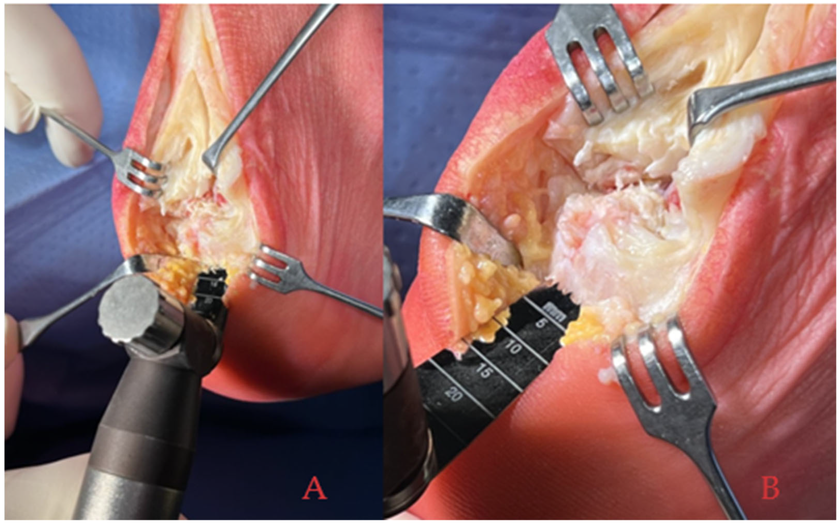 Medicina 61 01445 g002 Medicina 61 01445 g002