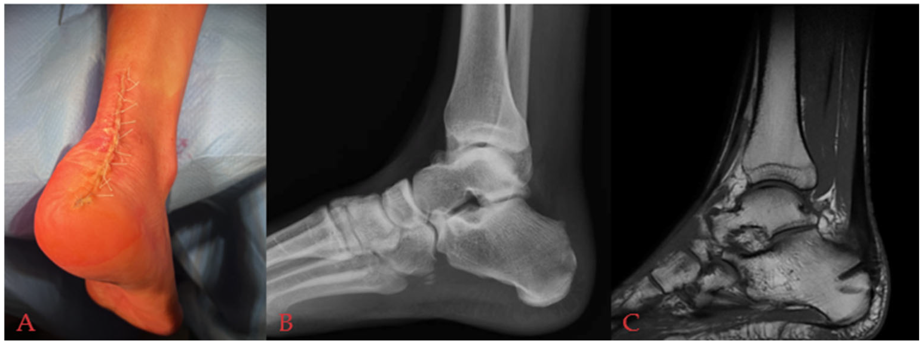 Medicina 61 01445 g004 Medicina 61 01445 g004