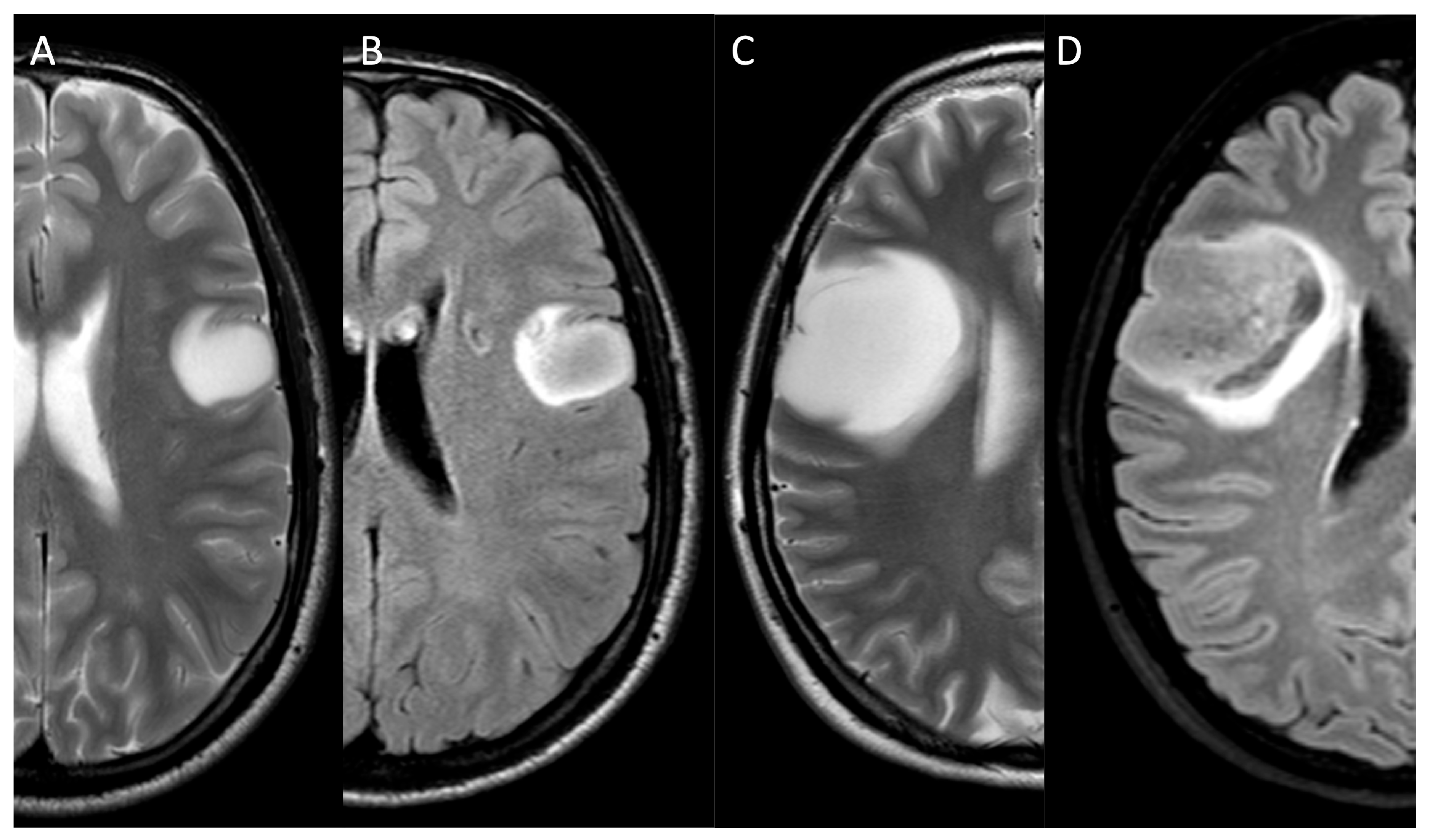 Medicina 61 01453 g001