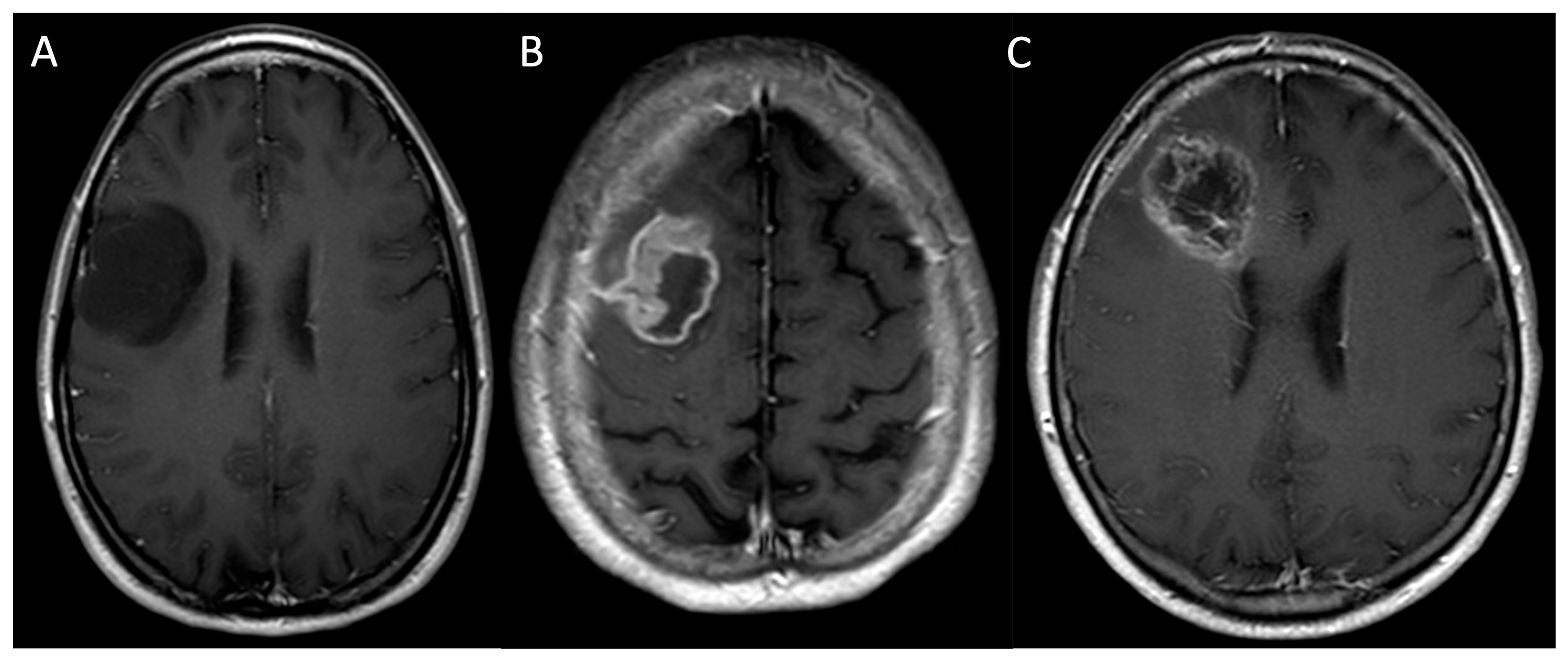 Medicina 61 01453 g002