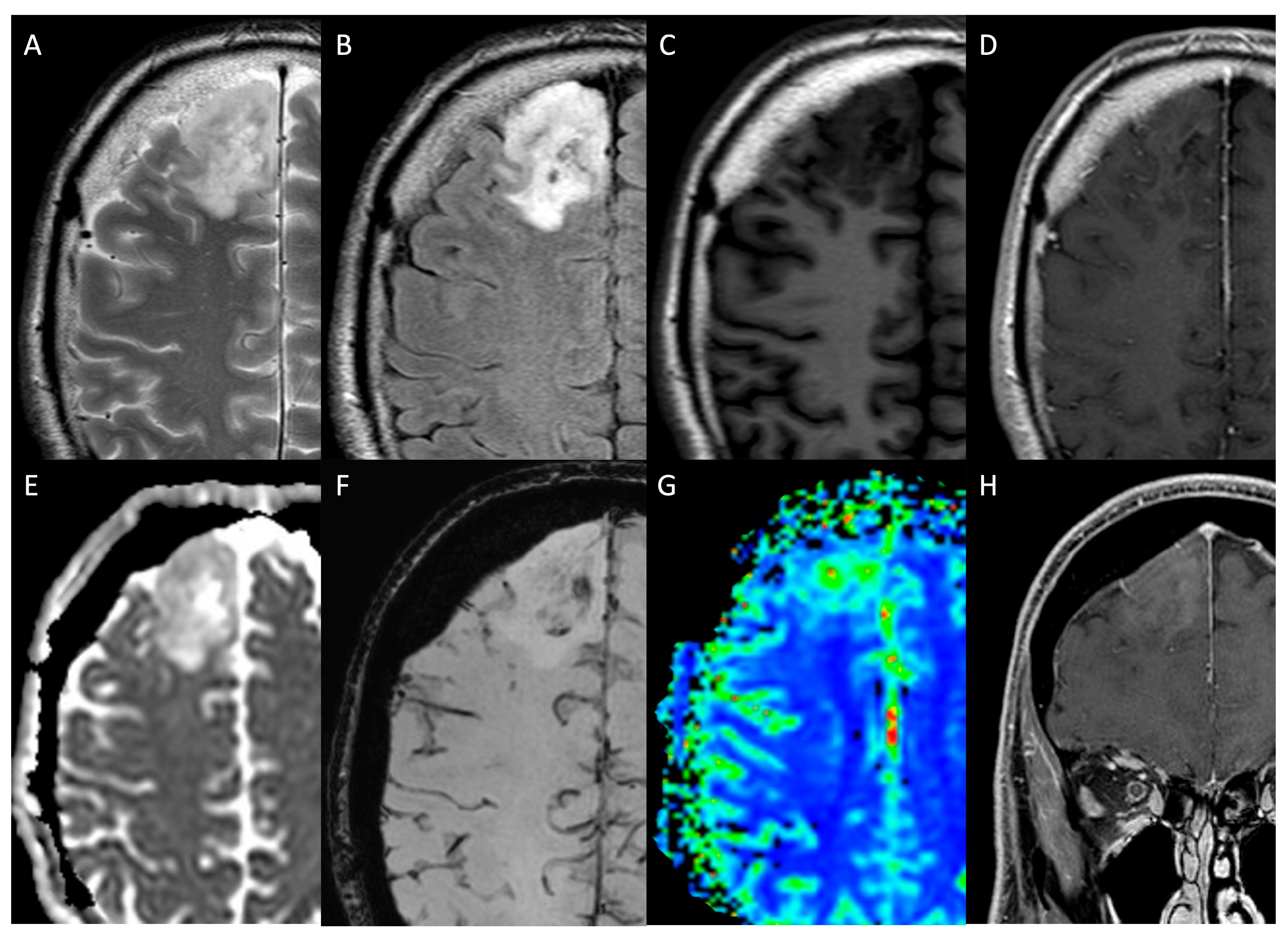 Medicina 61 01453 g003