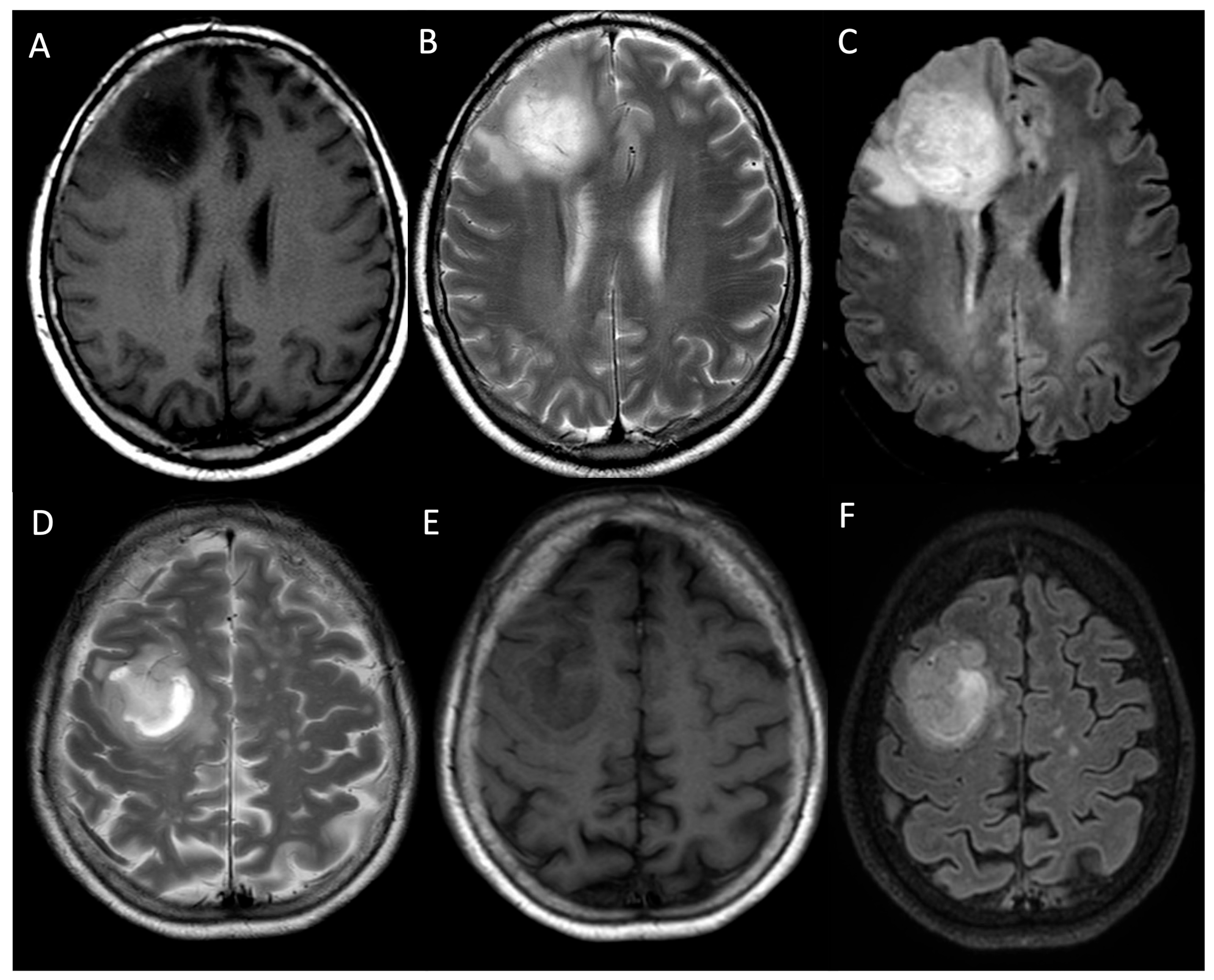 Medicina 61 01453 g005