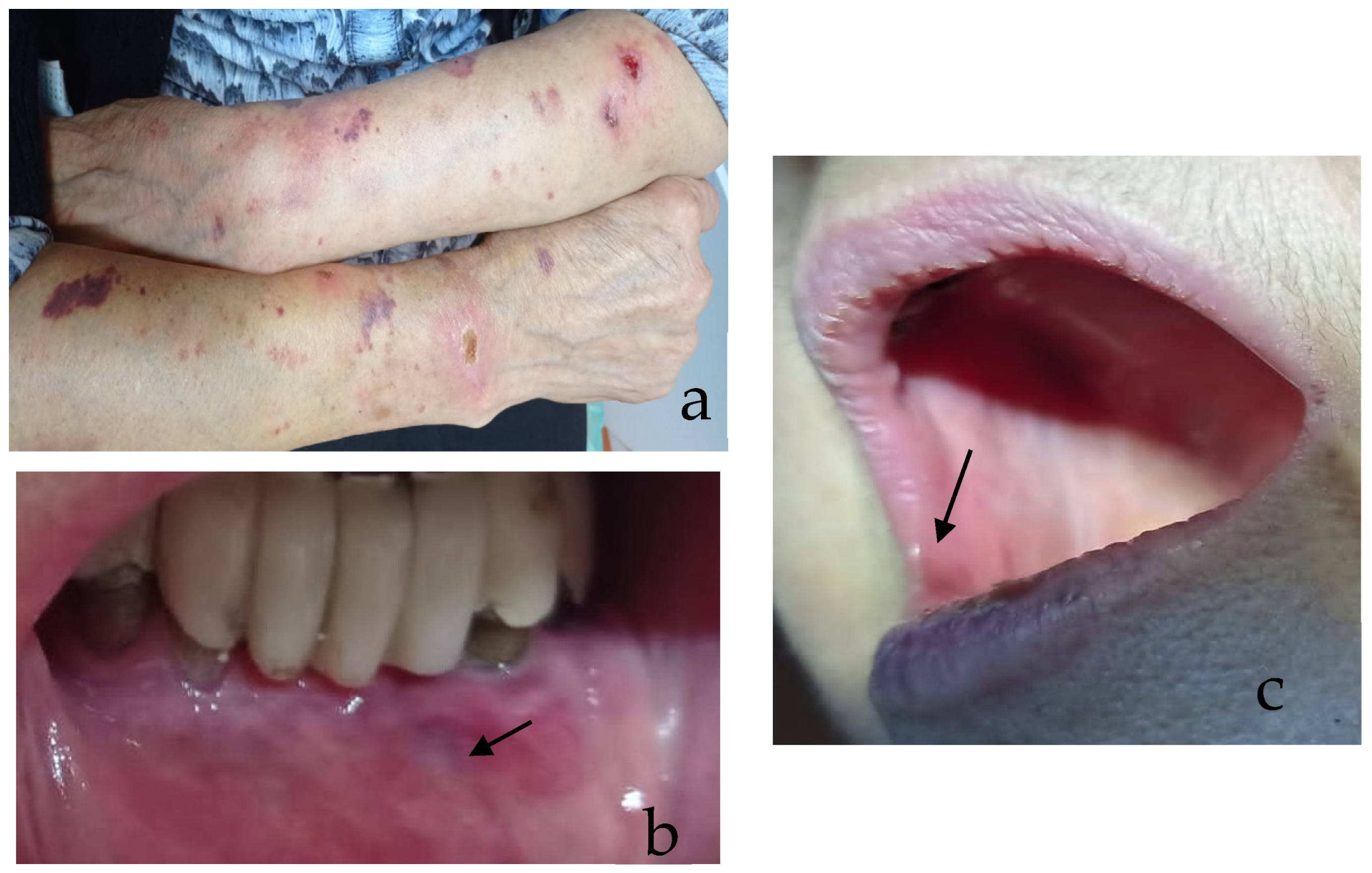 Medicina 61 01483 g005
