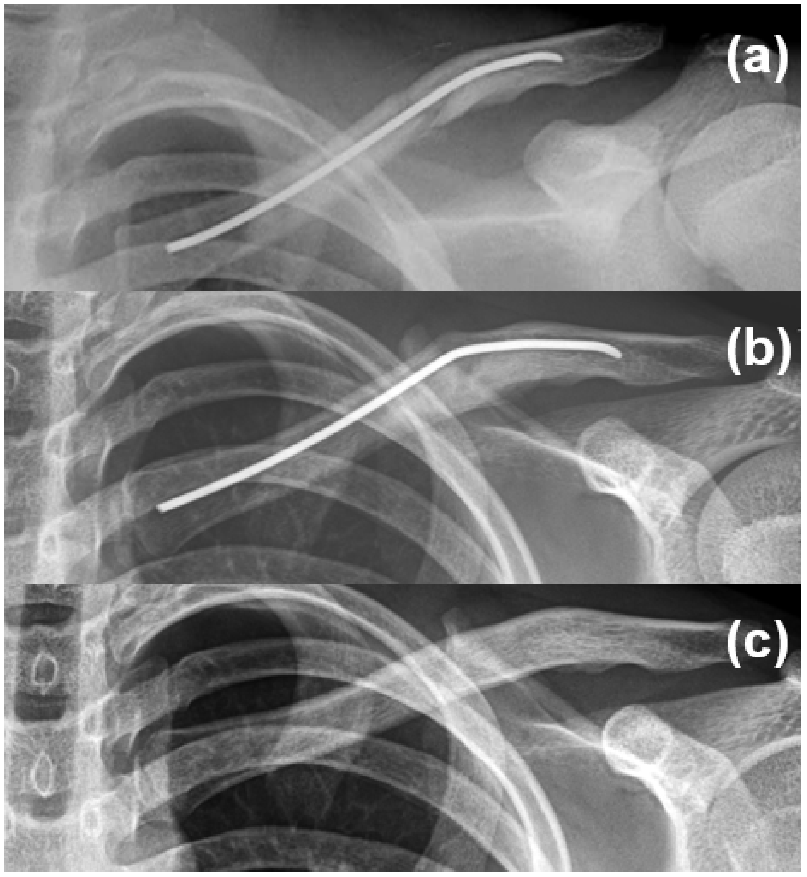 Medicina 61 01494 g002