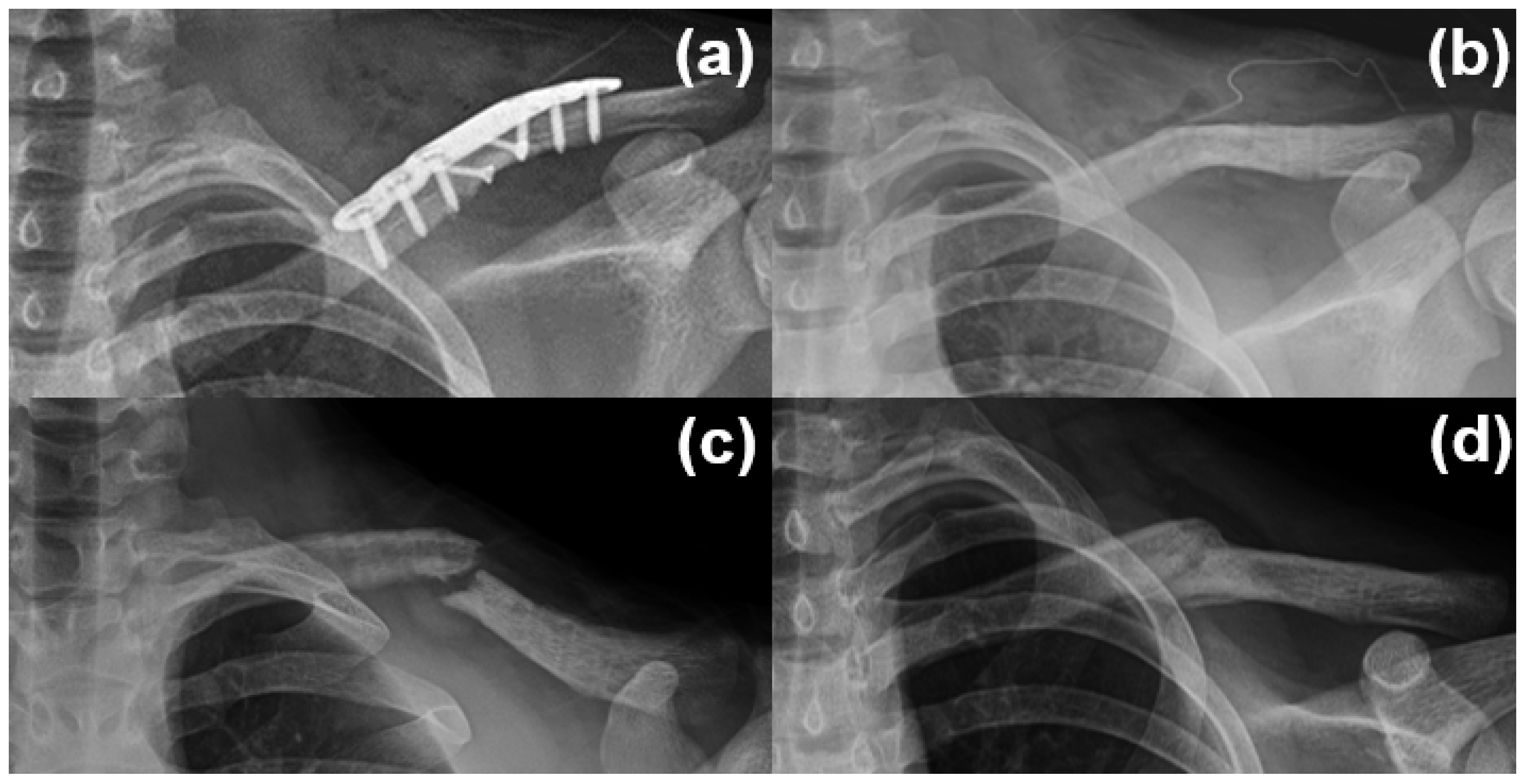 Medicina 61 01494 g004