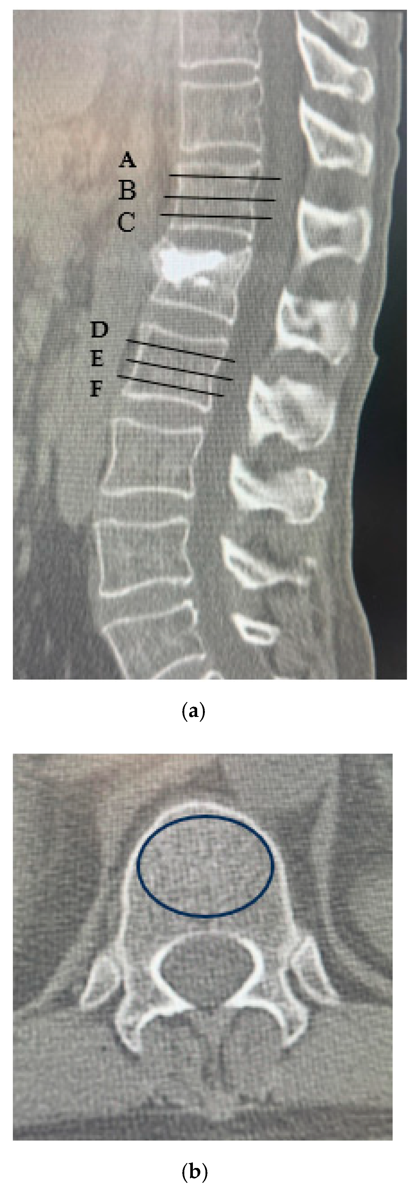 Medicina 61 01517 g001 Medicina 61 01517 g001