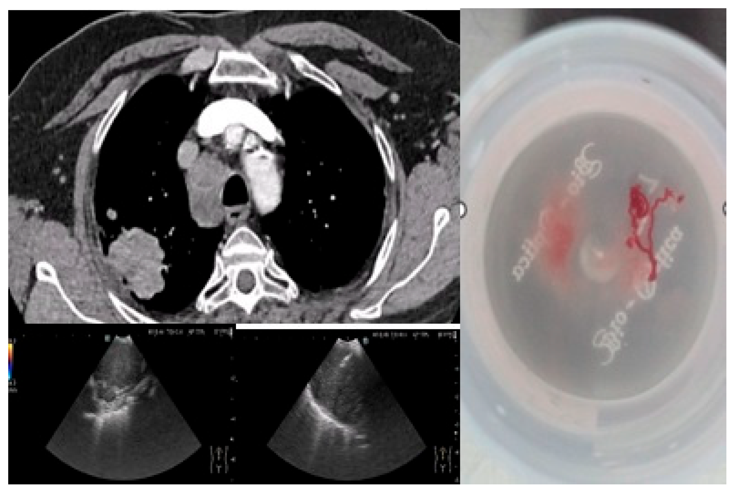 Medicina 61 01528 g002