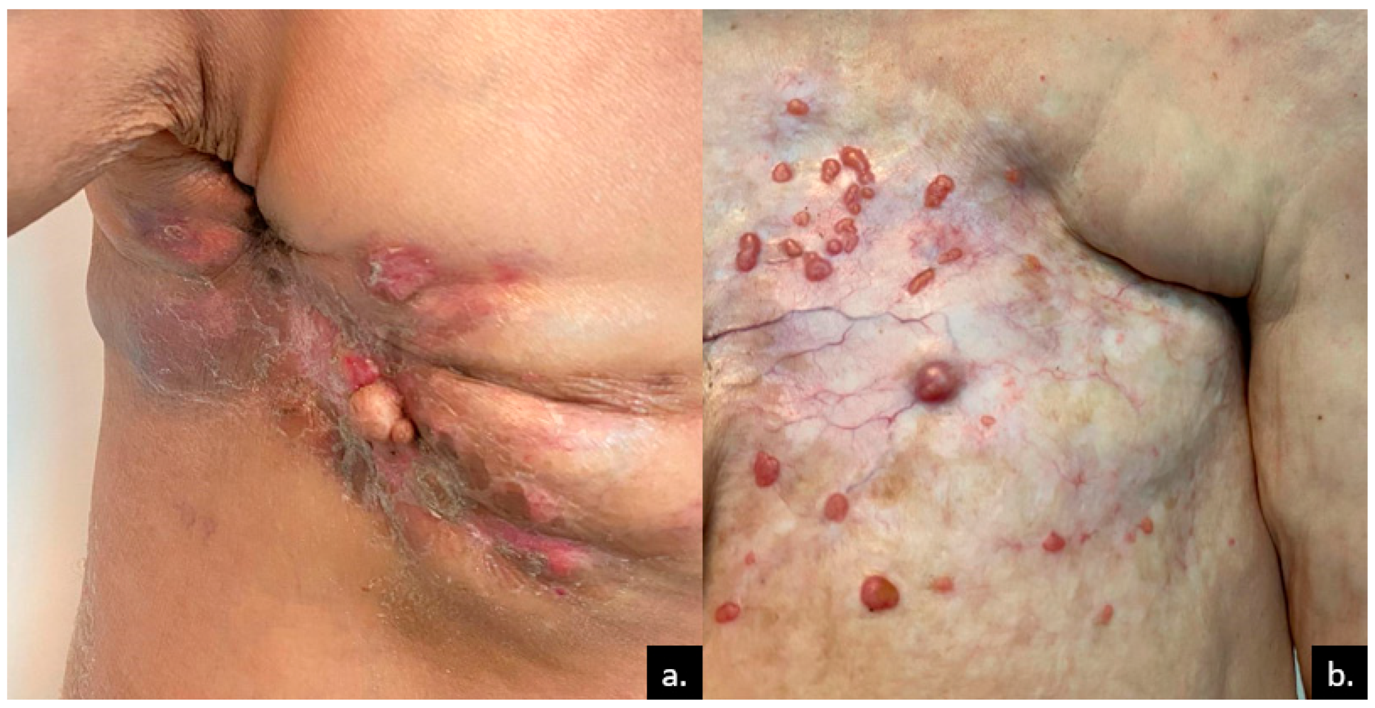 Medicina 61 01570 g001