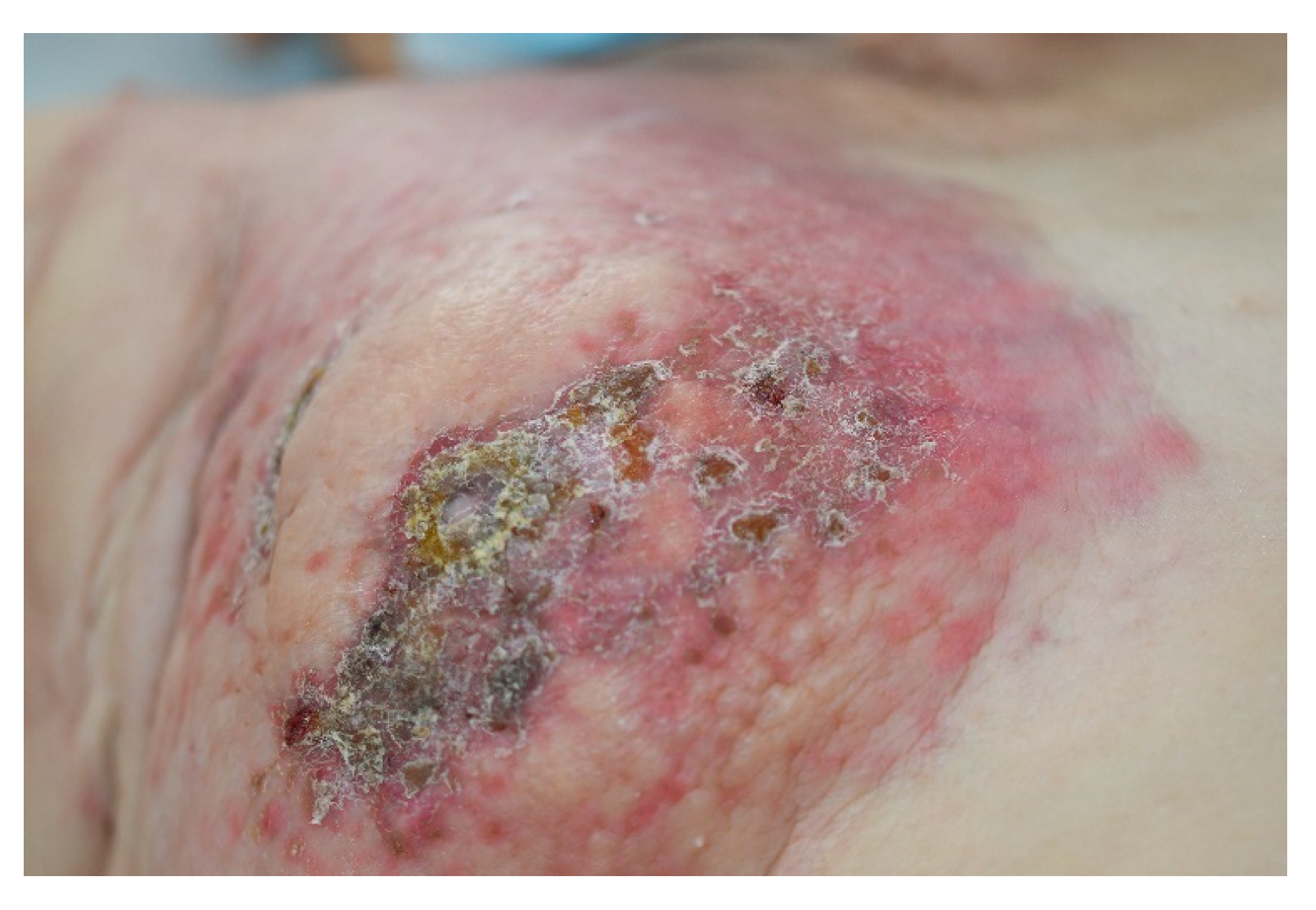 Medicina 61 01570 g002