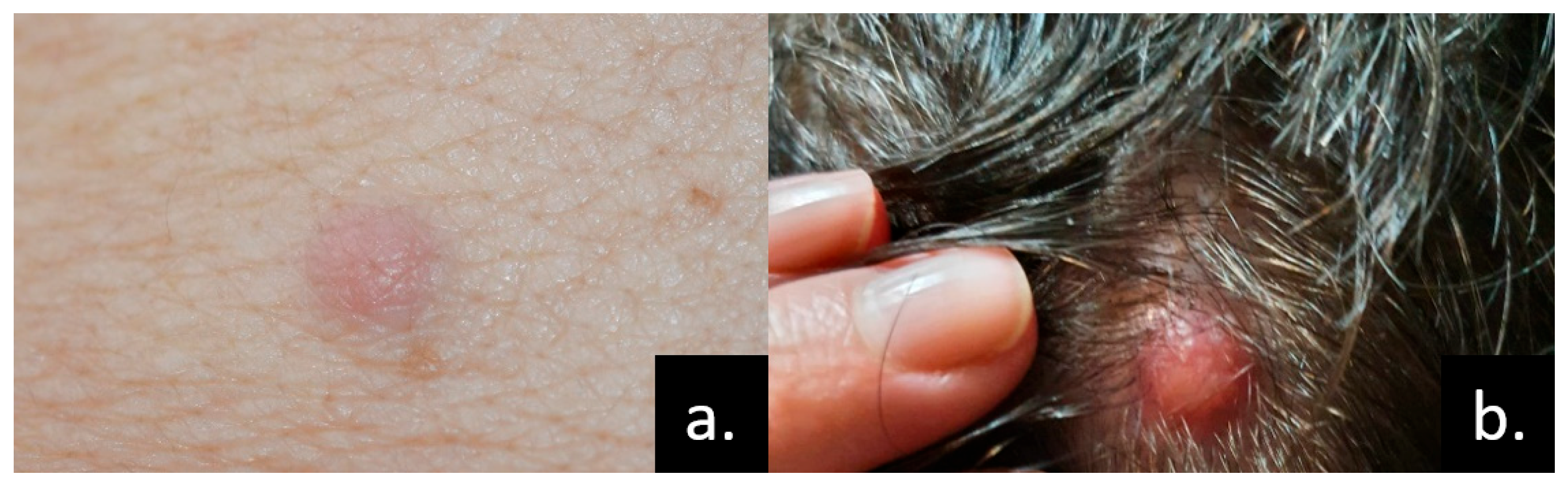 Medicina 61 01570 g005