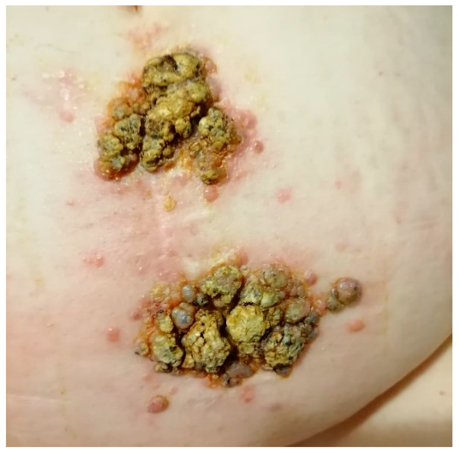 Medicina 61 01570 g007