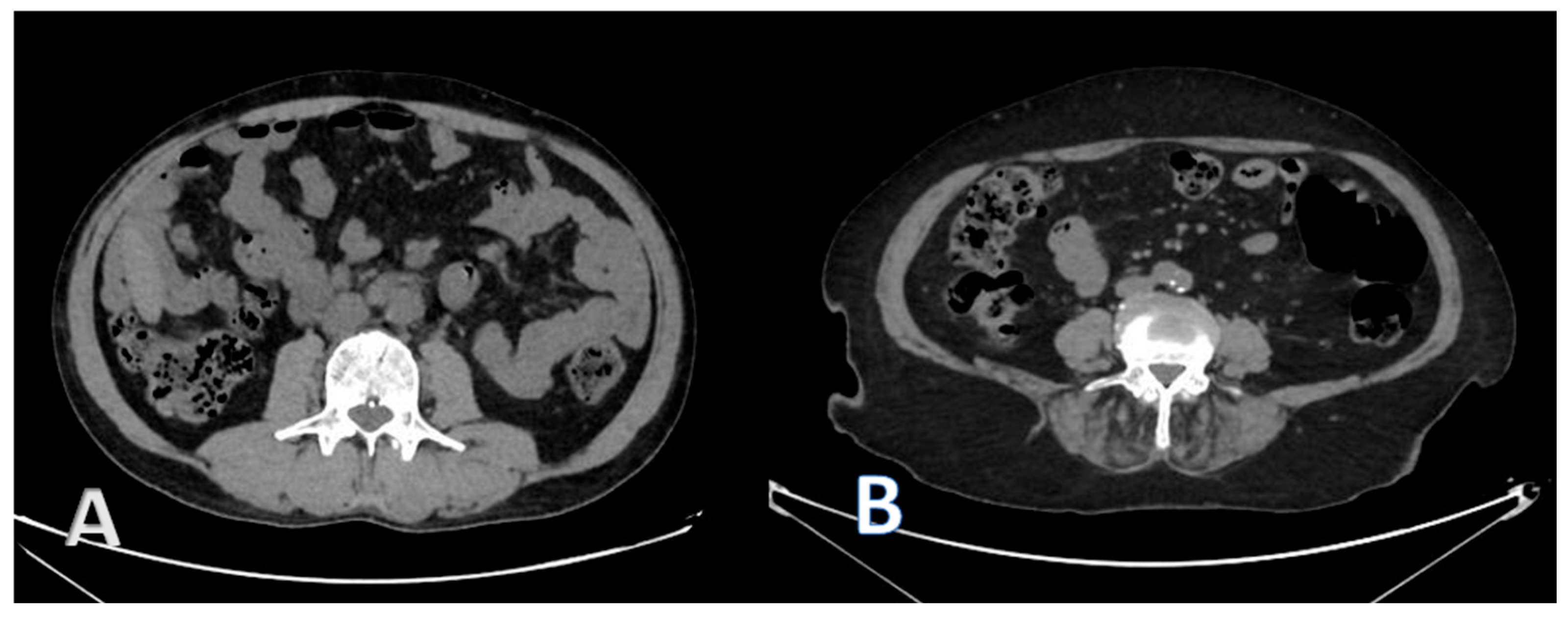 Medicina 61 01608 g001