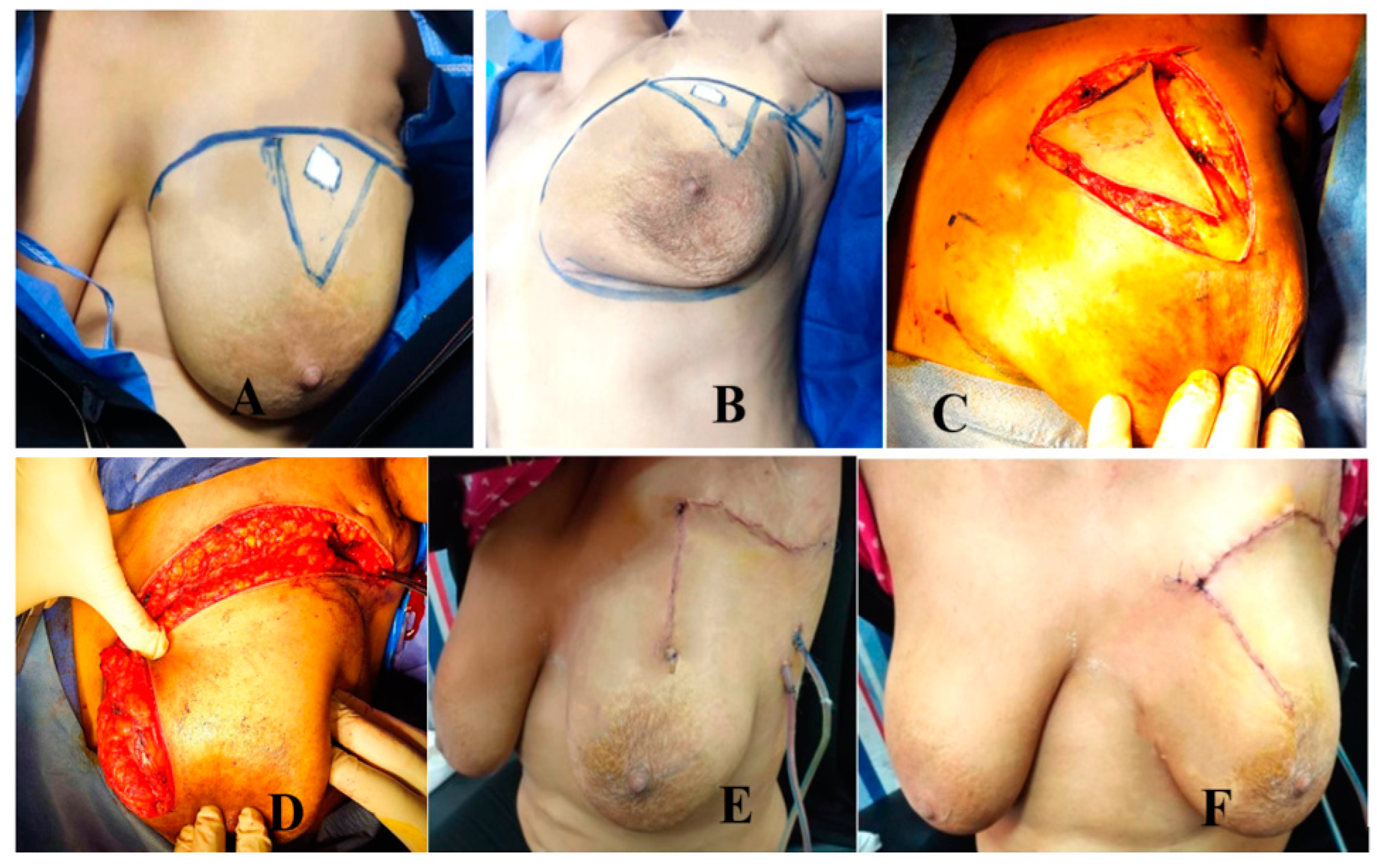 Medicina 61 01609 g003