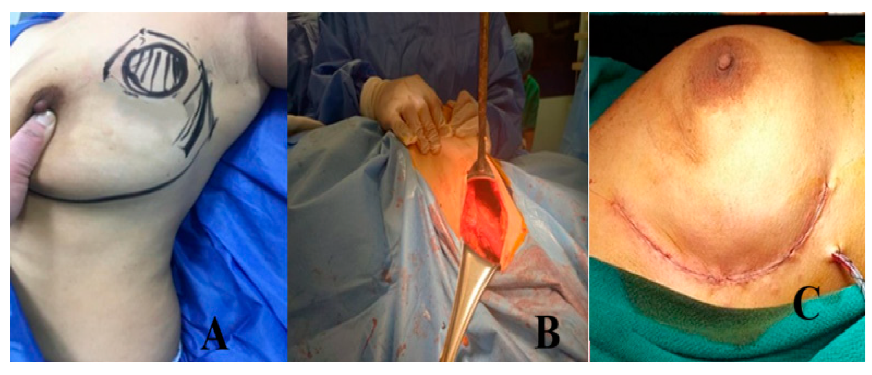 Medicina 61 01609 g004