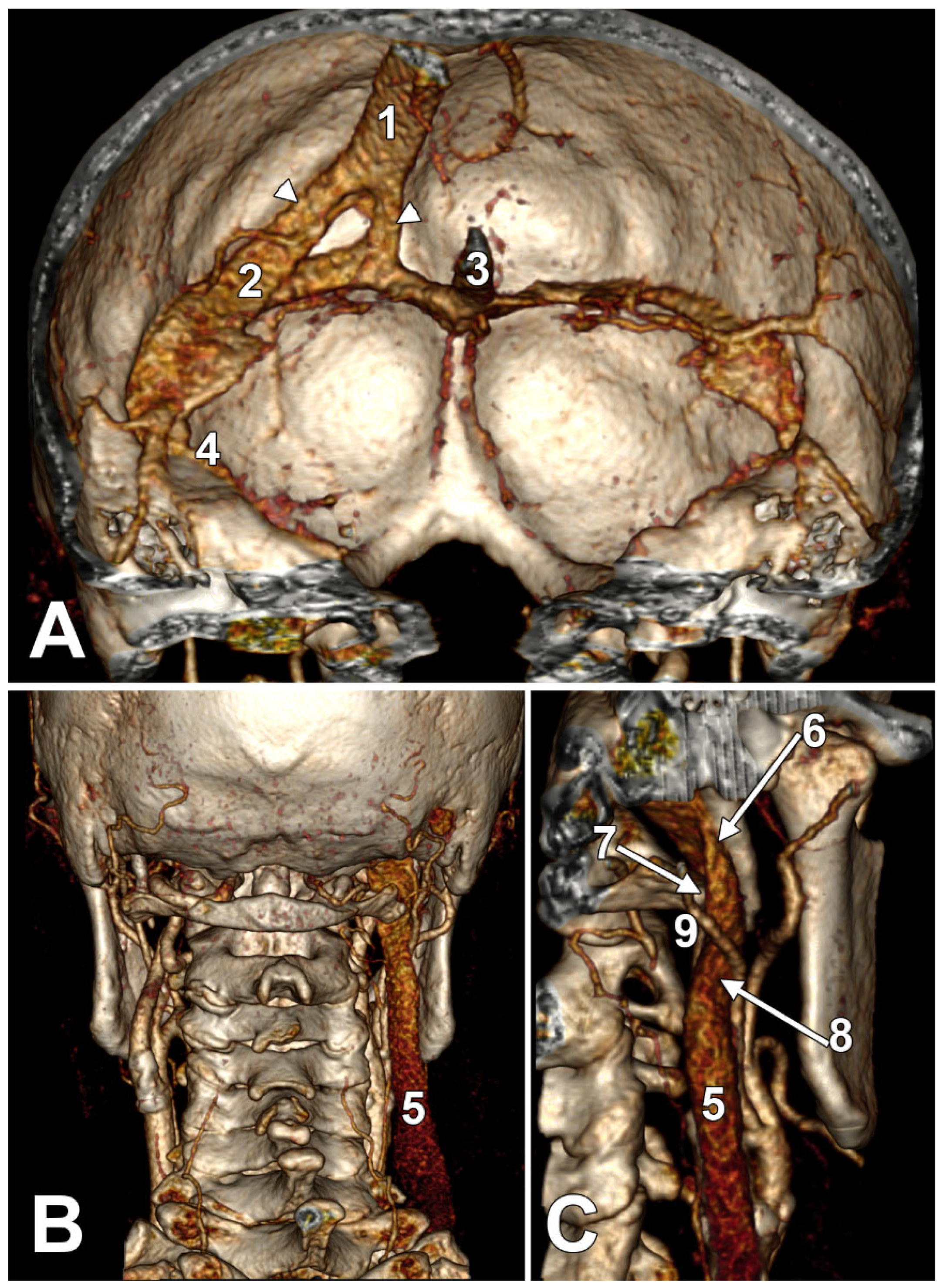 Medicina 61 01627 g004