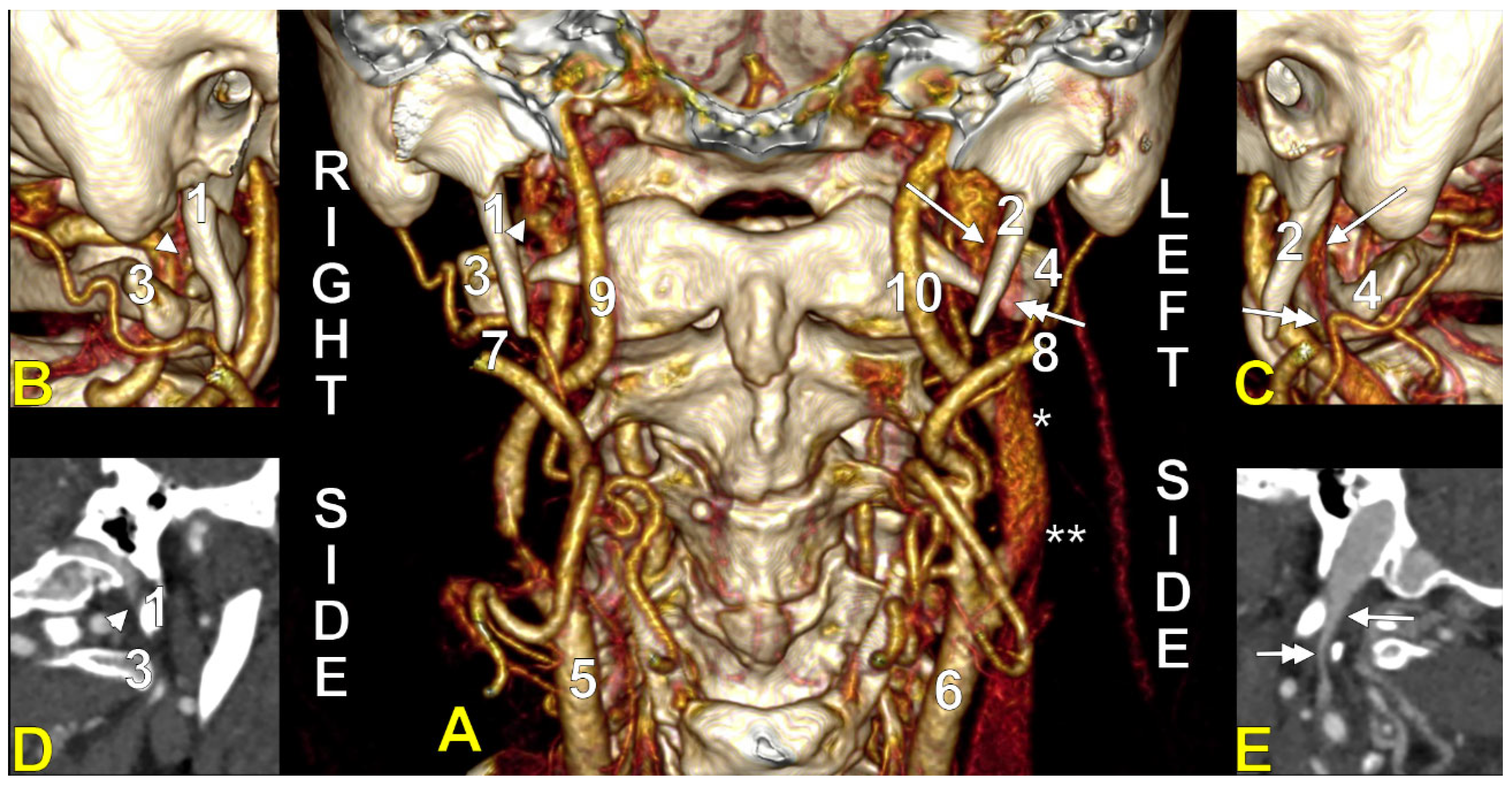 Medicina 61 01627 g005