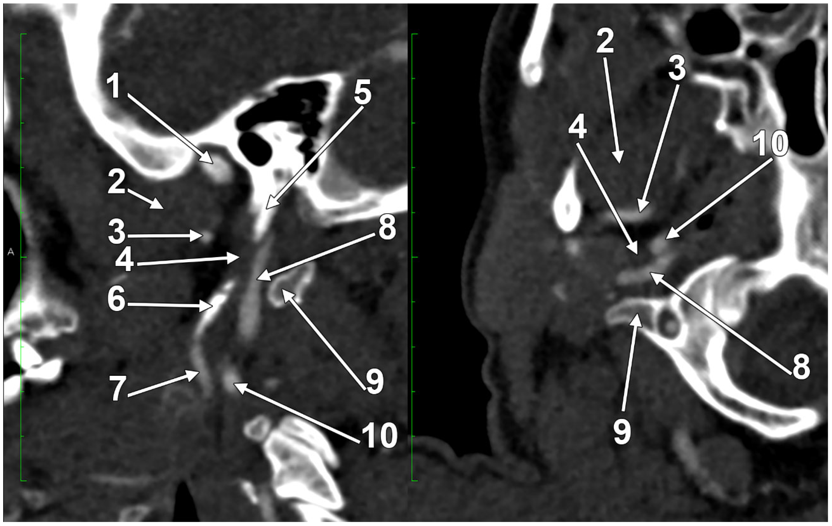 Medicina 61 01627 g006