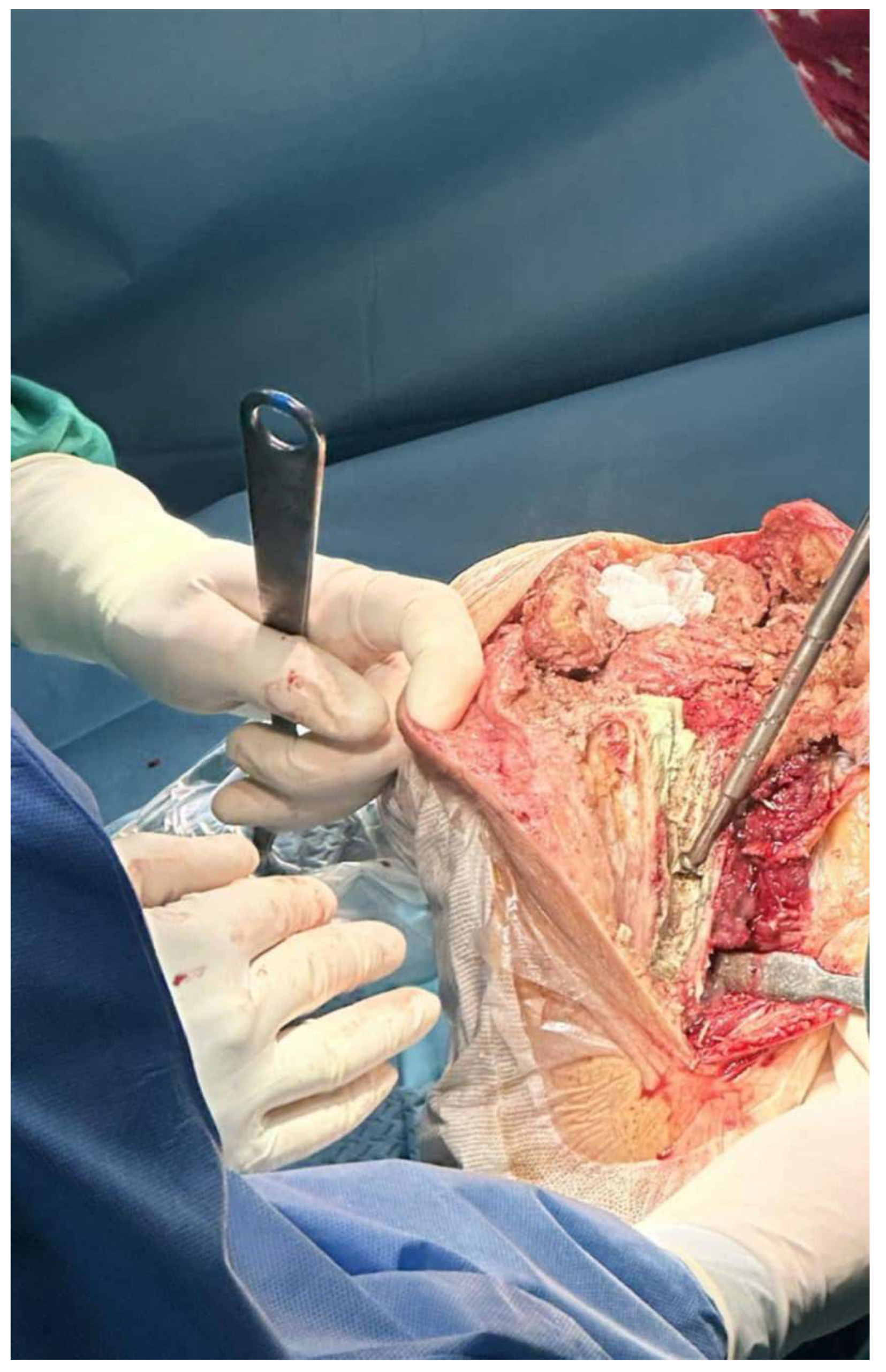 Medicina 61 01670 g001