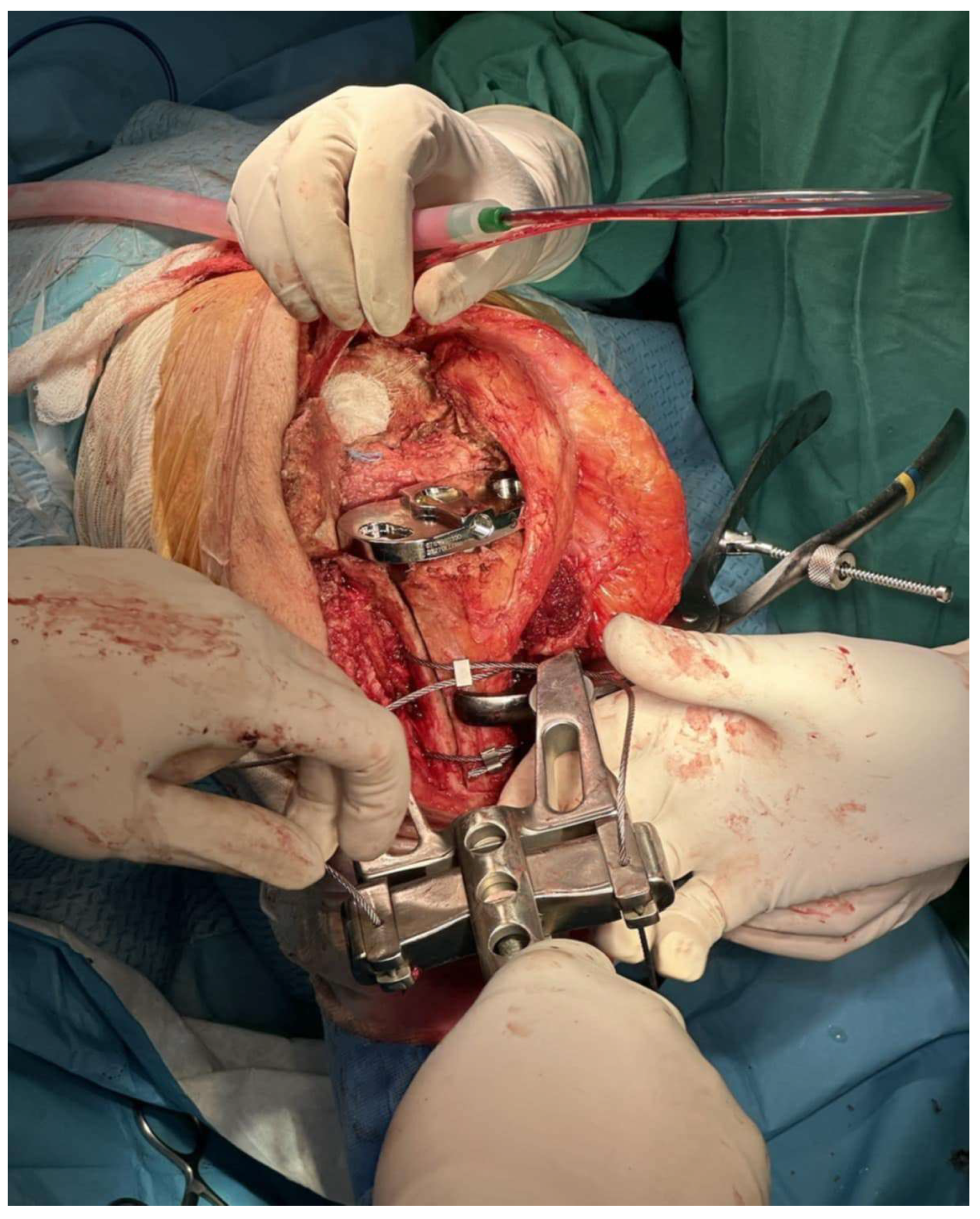 Medicina 61 01670 g002