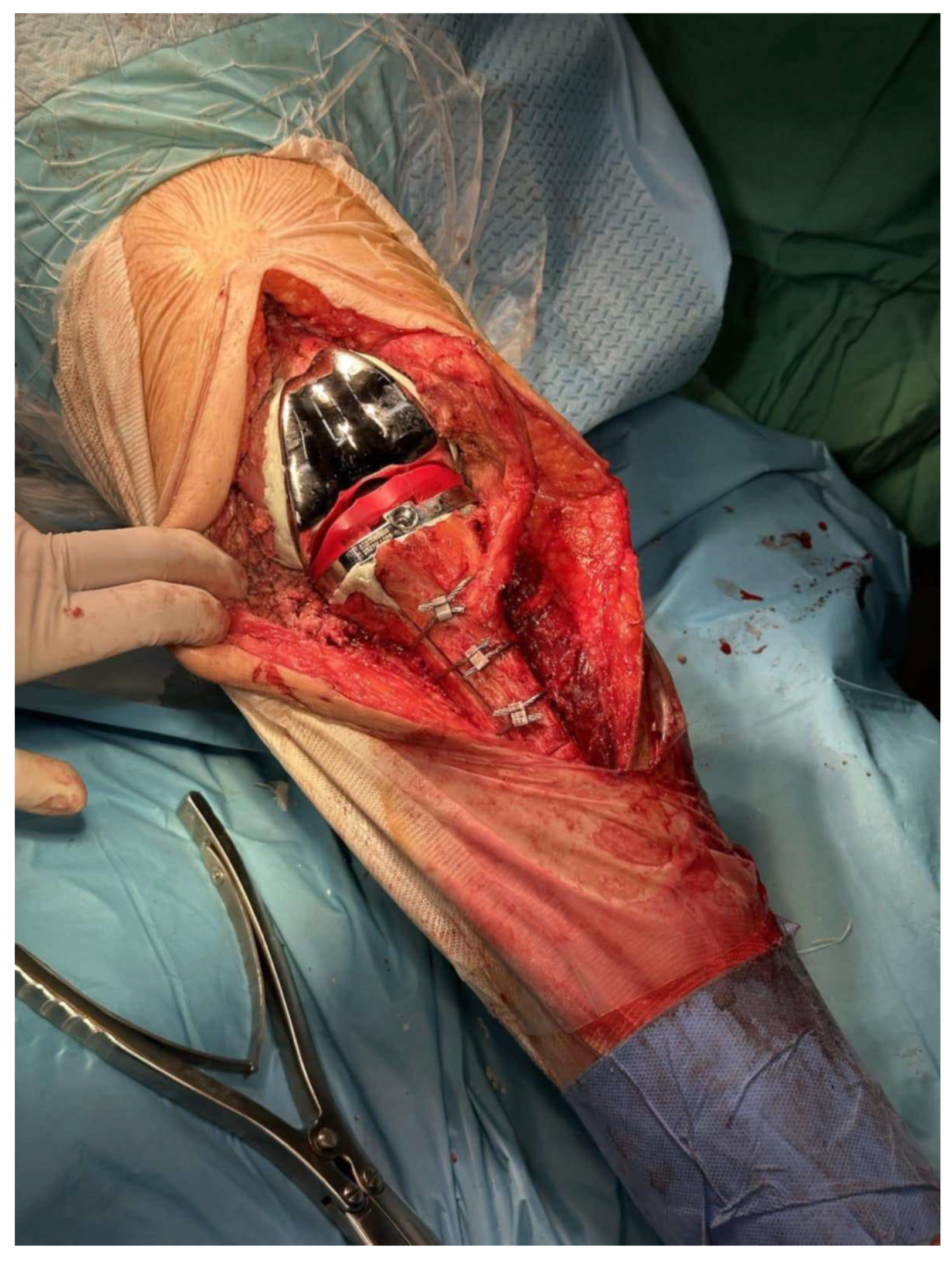 Medicina 61 01670 g003