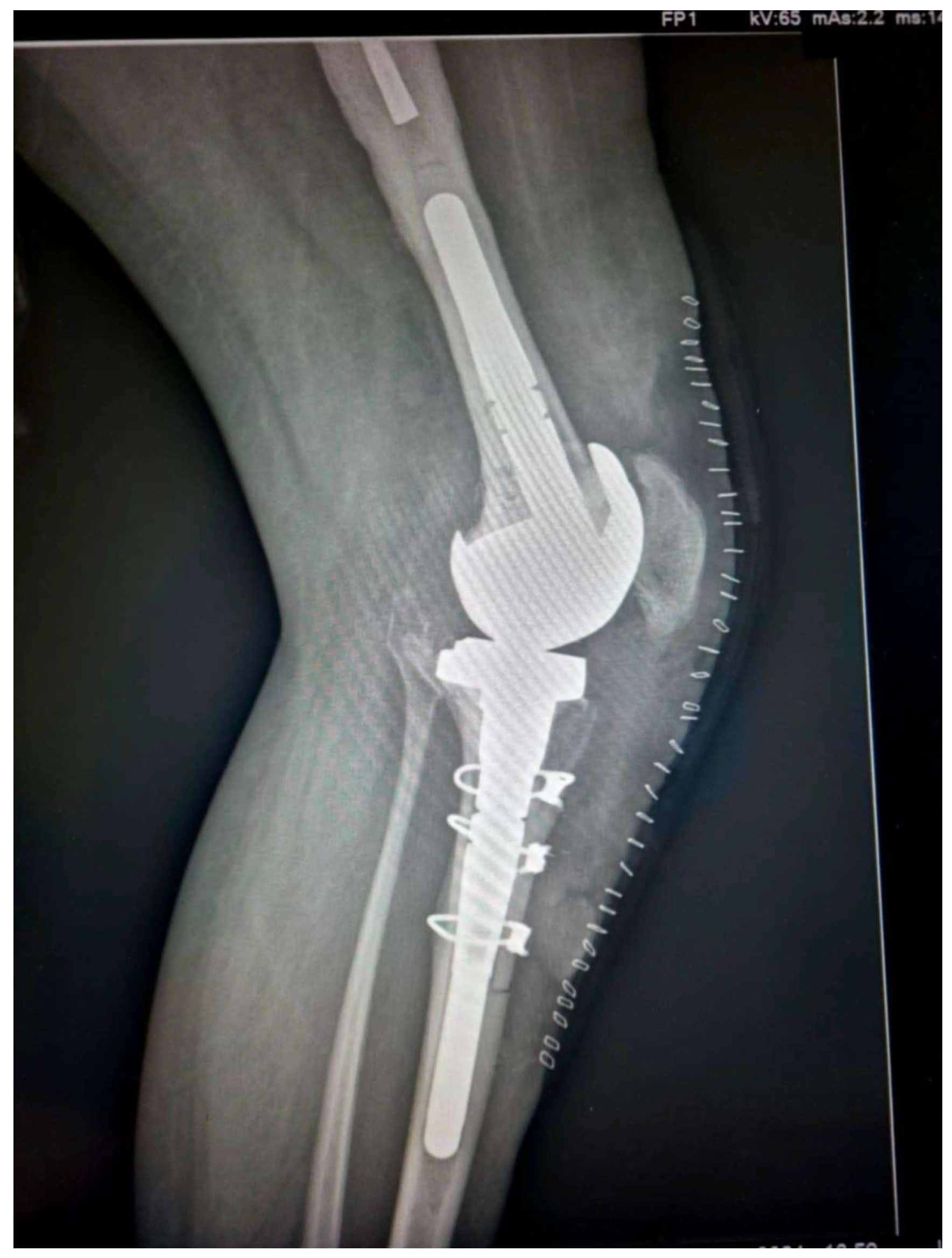 Medicina 61 01670 g004