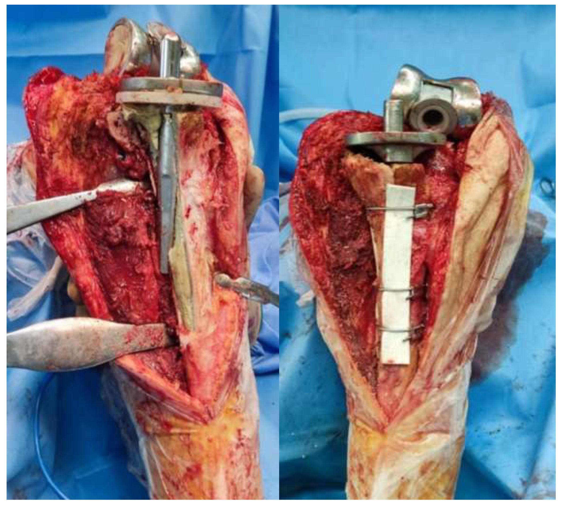 Medicina 61 01670 g005