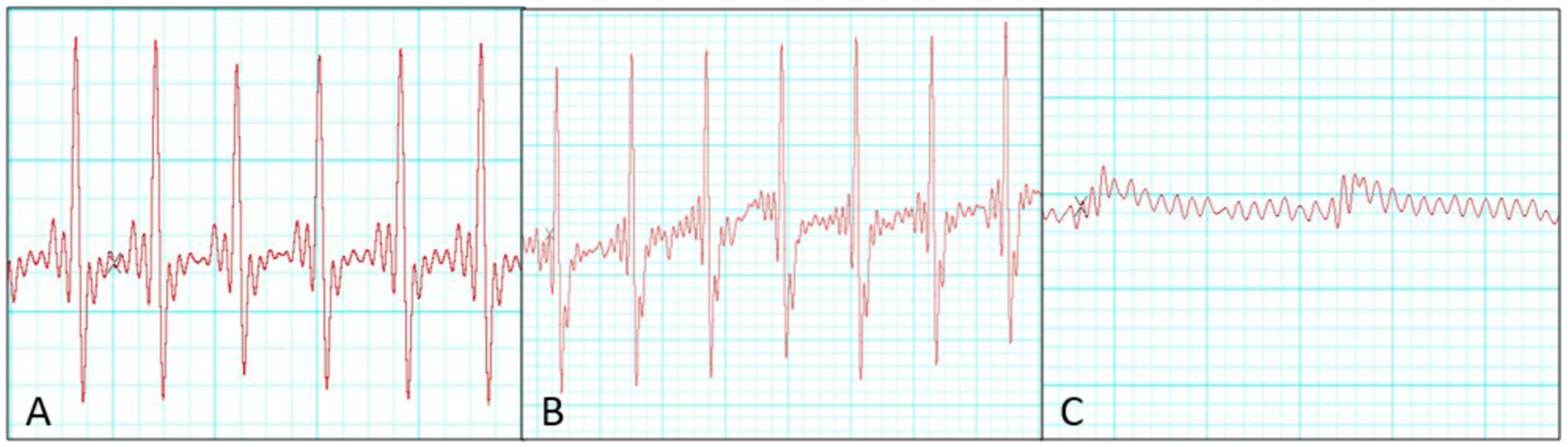 Medicina 61 01696 g003