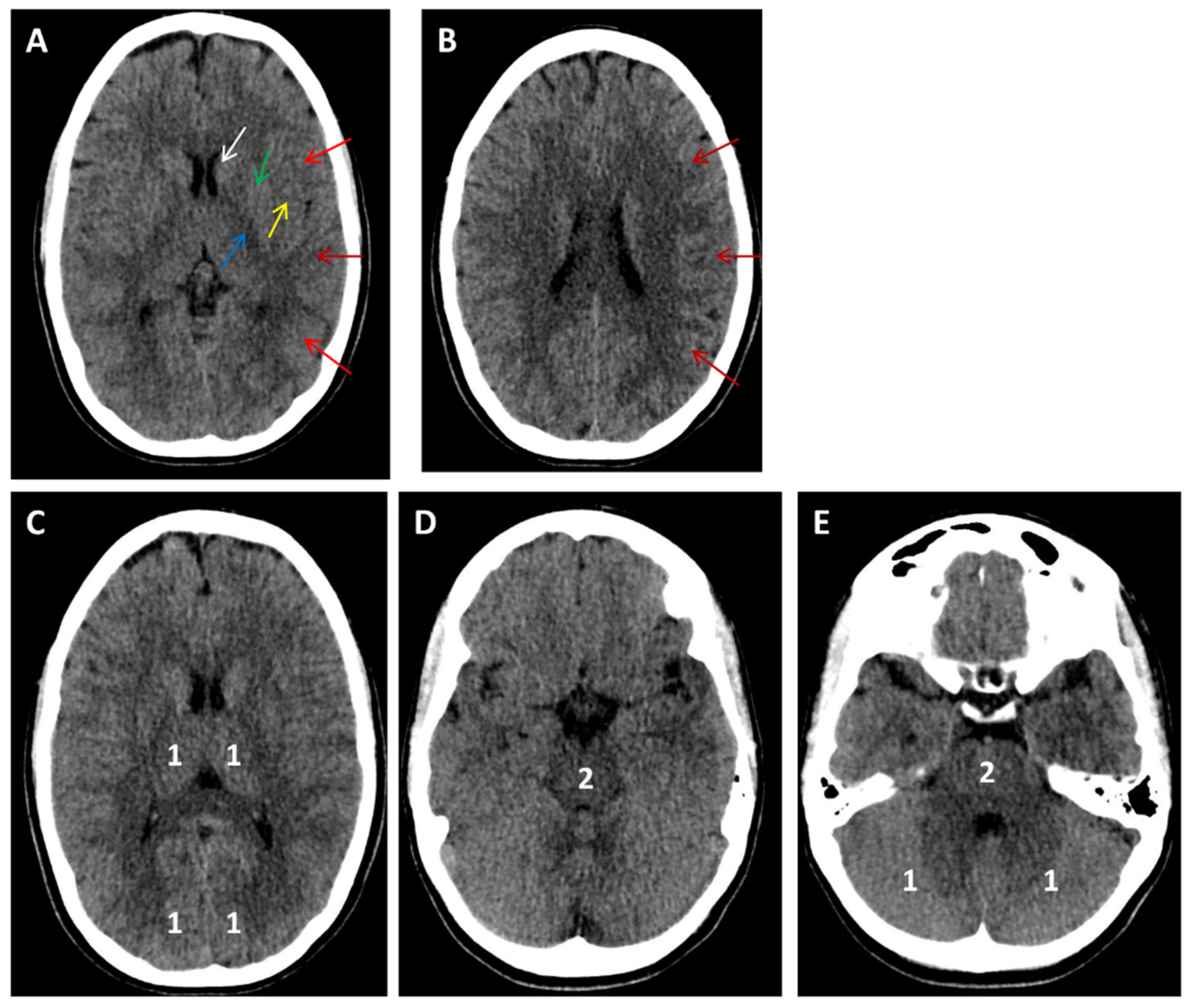 Medicina 61 01700 g008