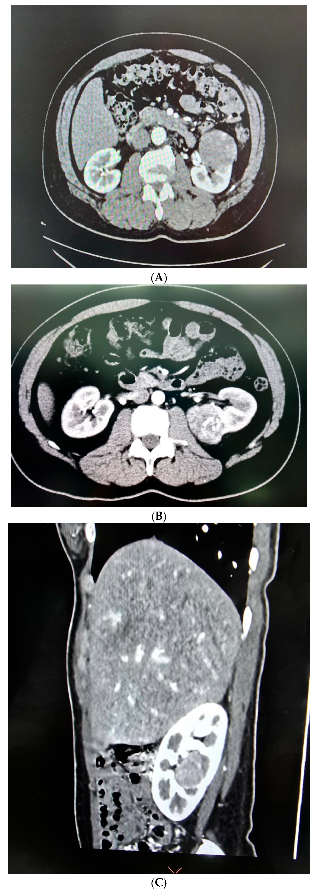 Medicina 61 01702 g003