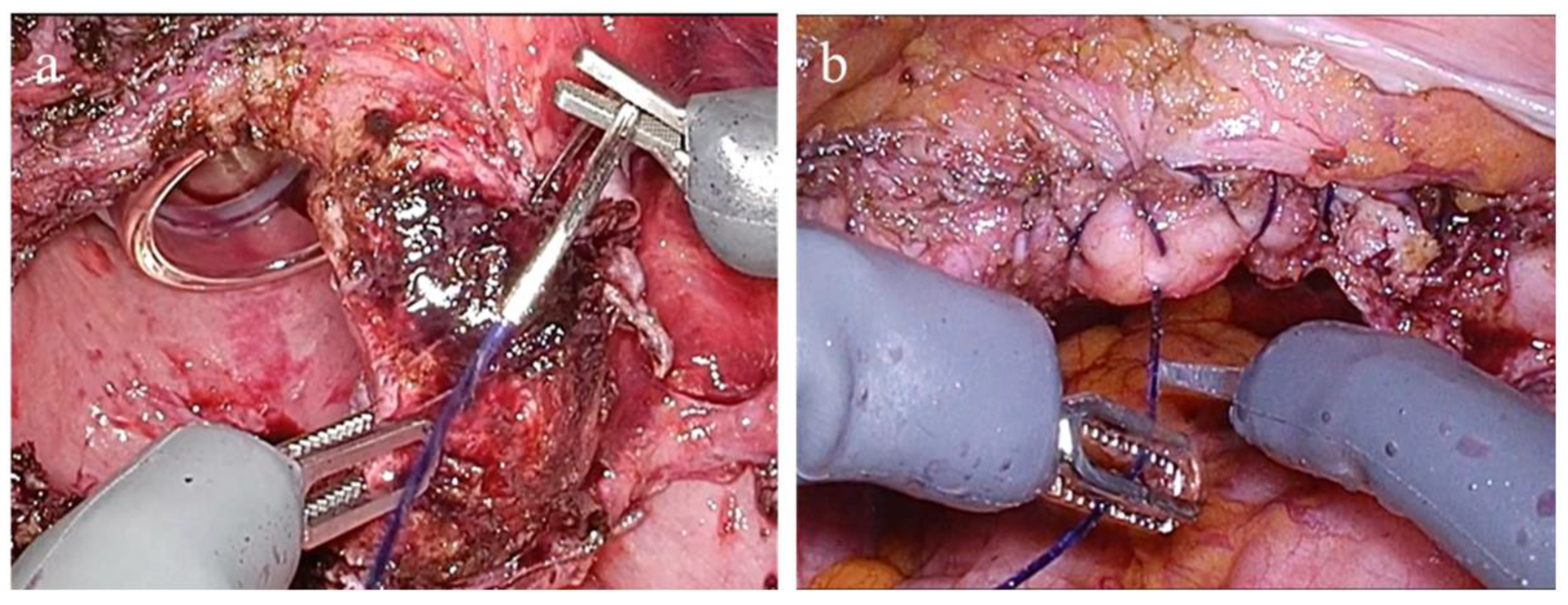 Medicina 61 01716 g004