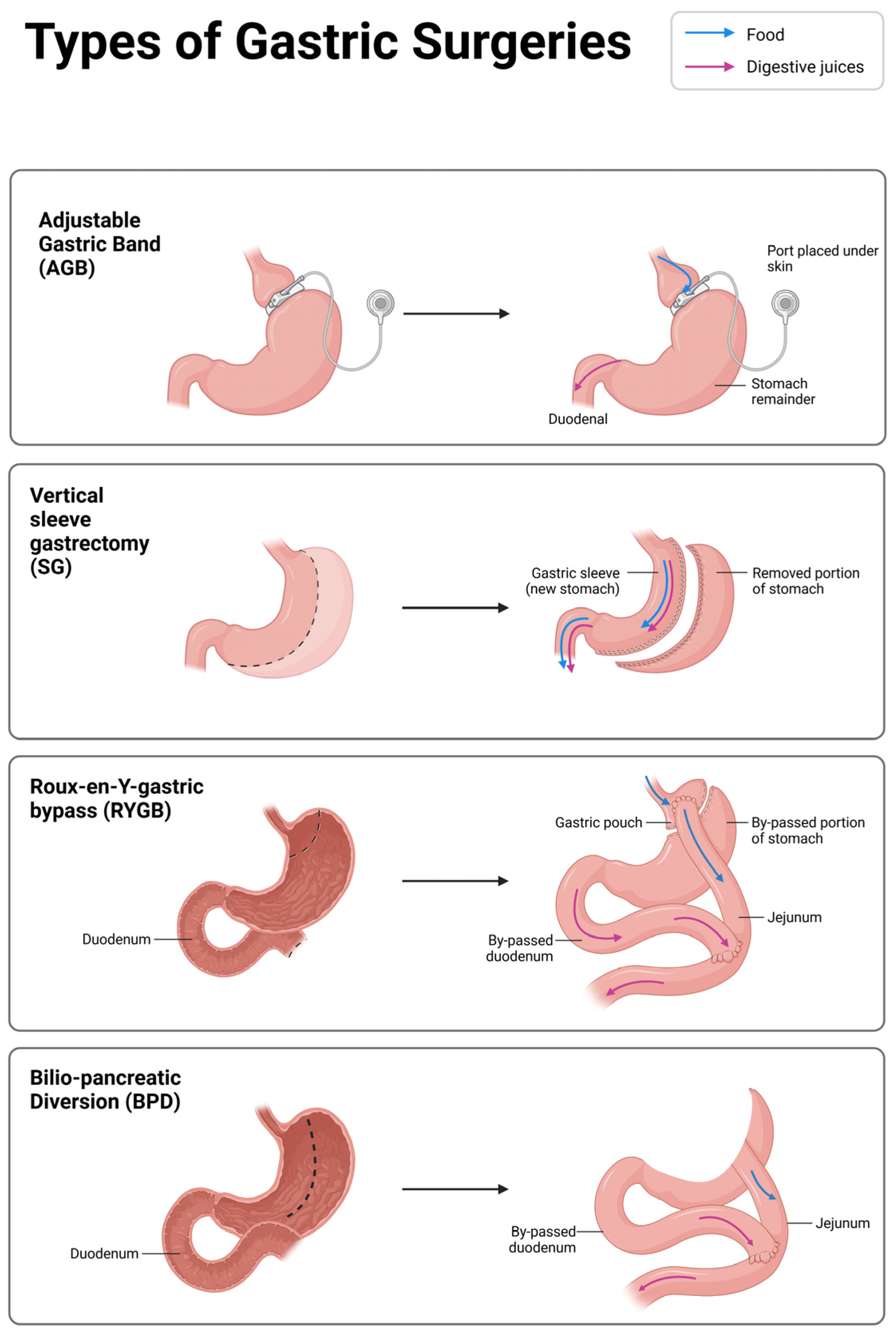 Medicina 61 01724 g001