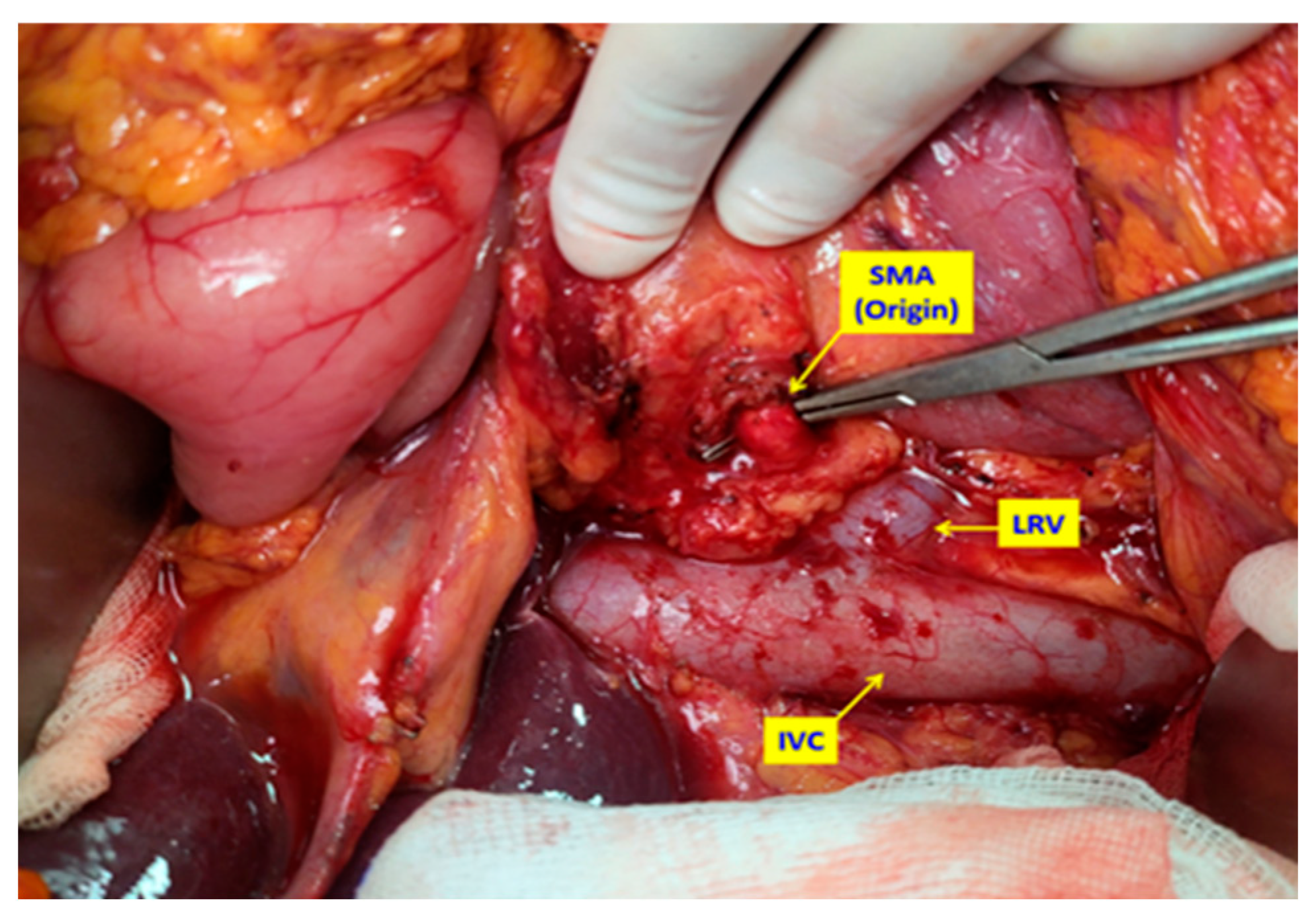 Medicina 61 01725 g001