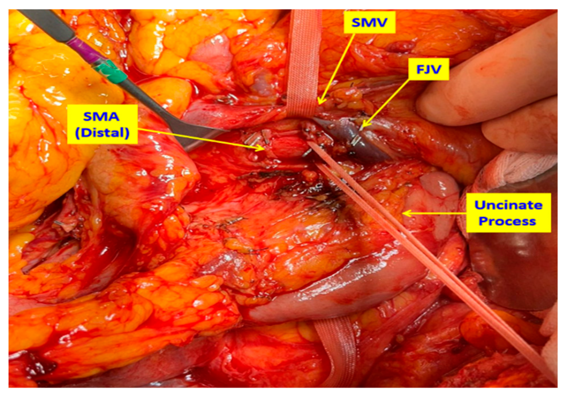 Medicina 61 01725 g002