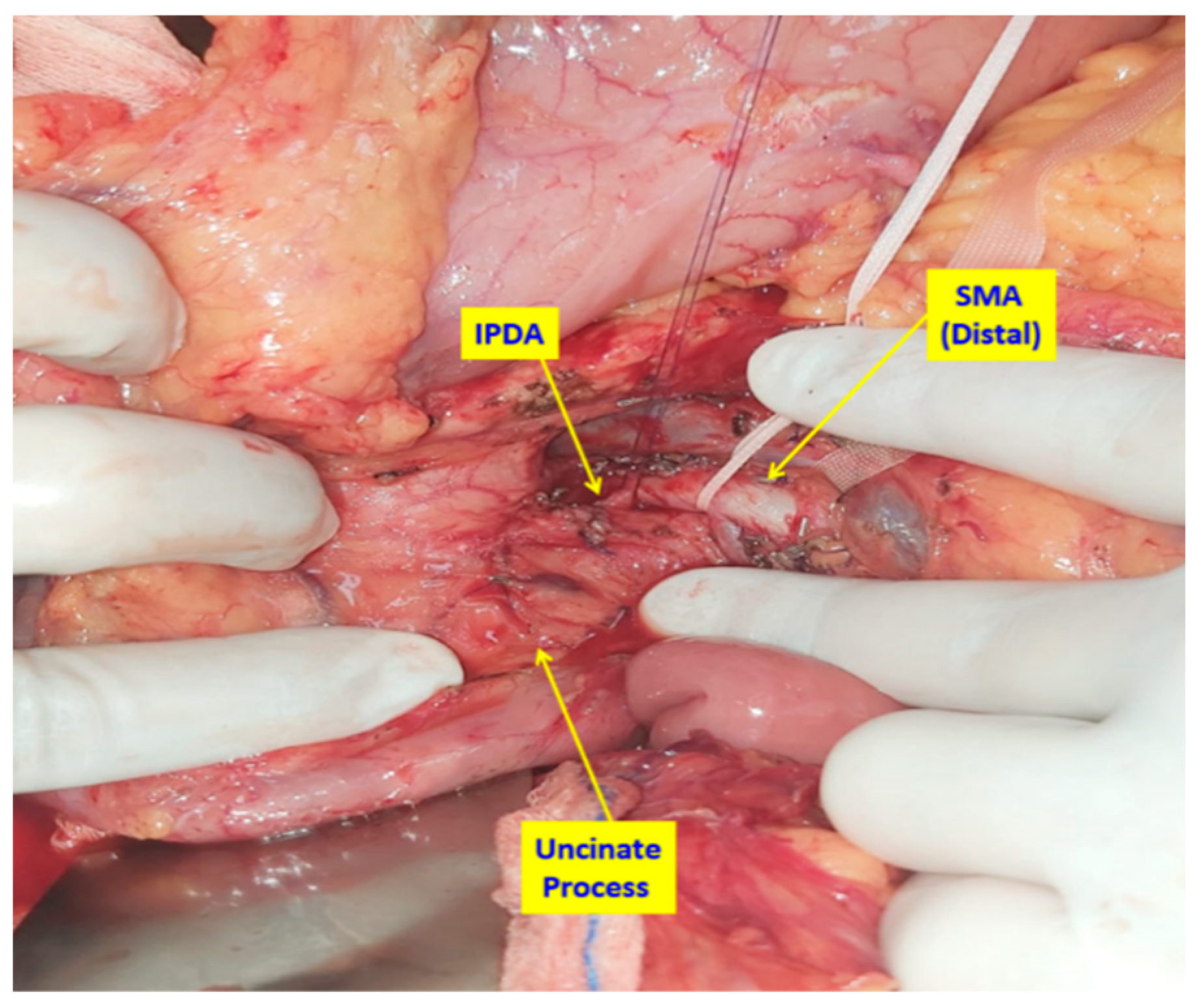 Medicina 61 01725 g003