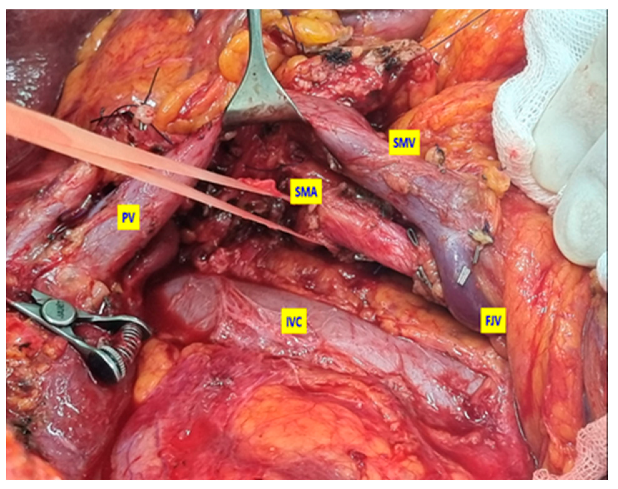 Medicina 61 01725 g004