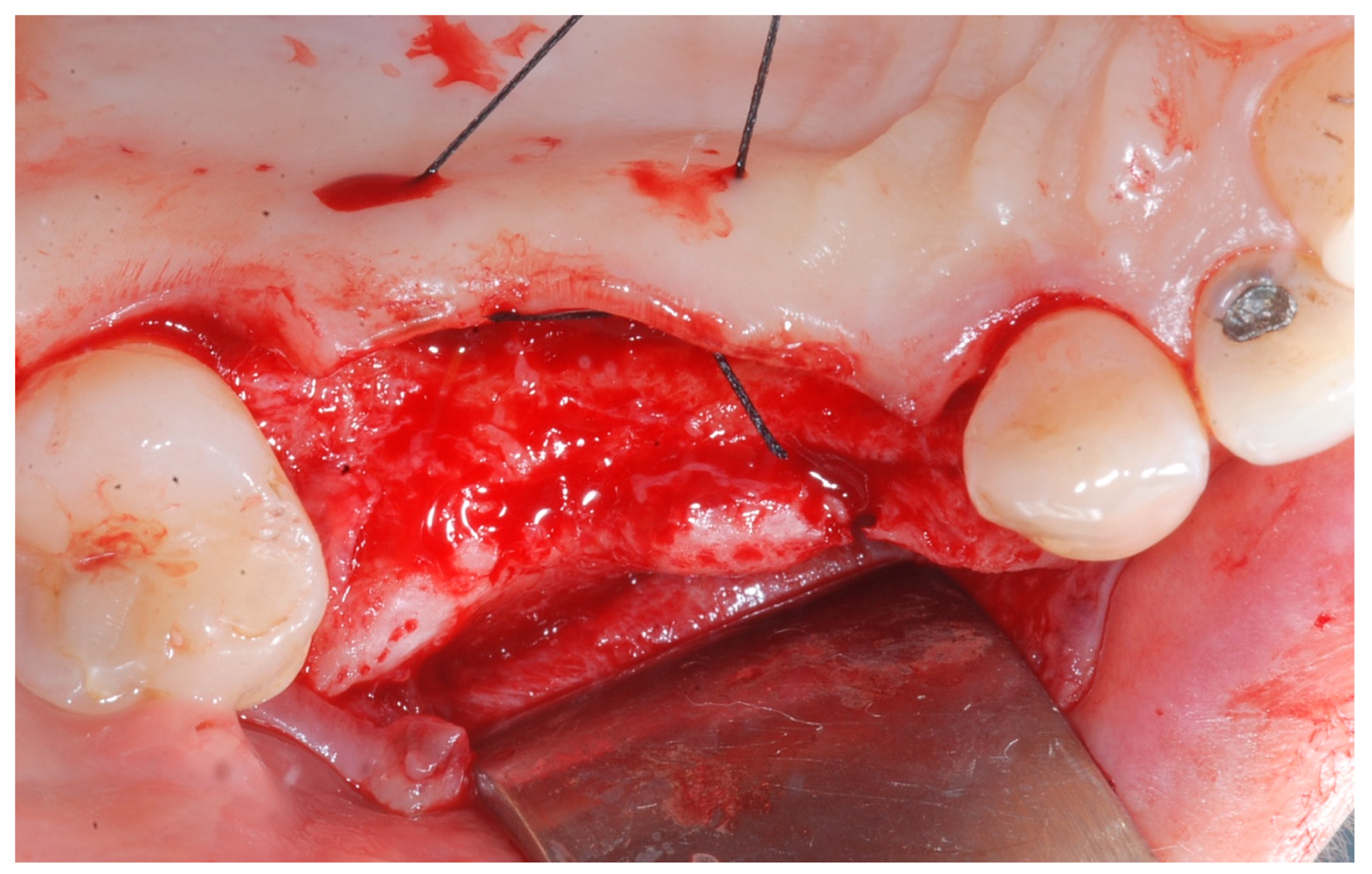 Medicina 61 01814 g002