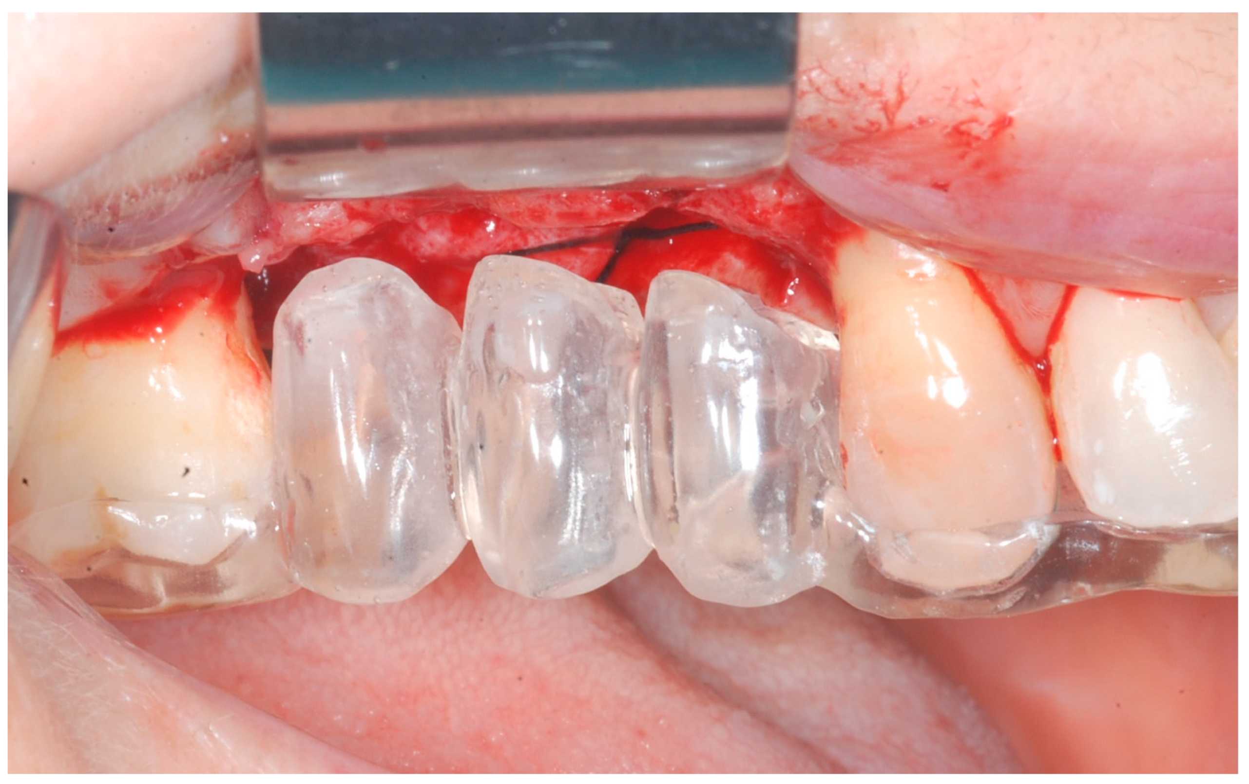 Medicina 61 01814 g003