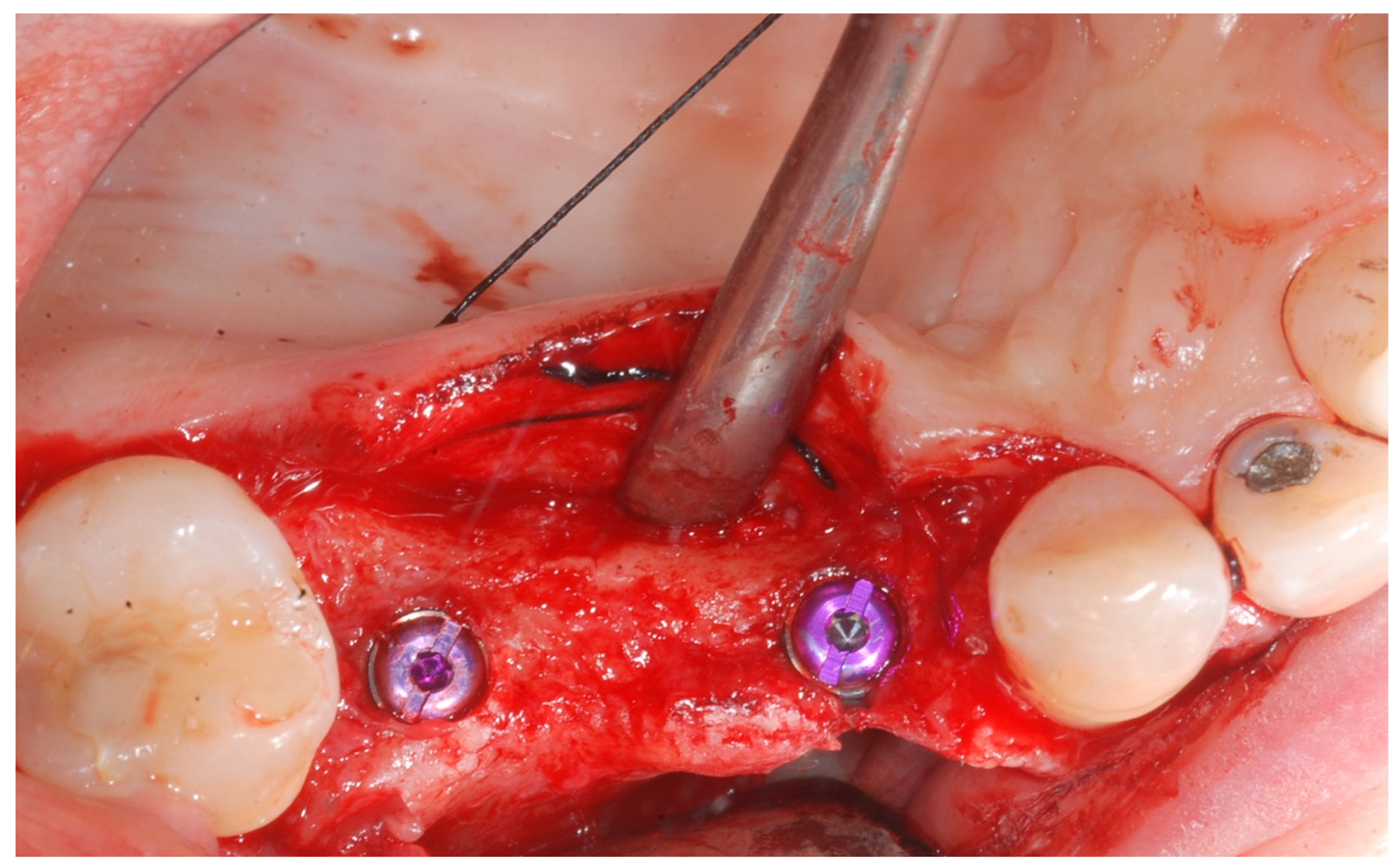 Medicina 61 01814 g004