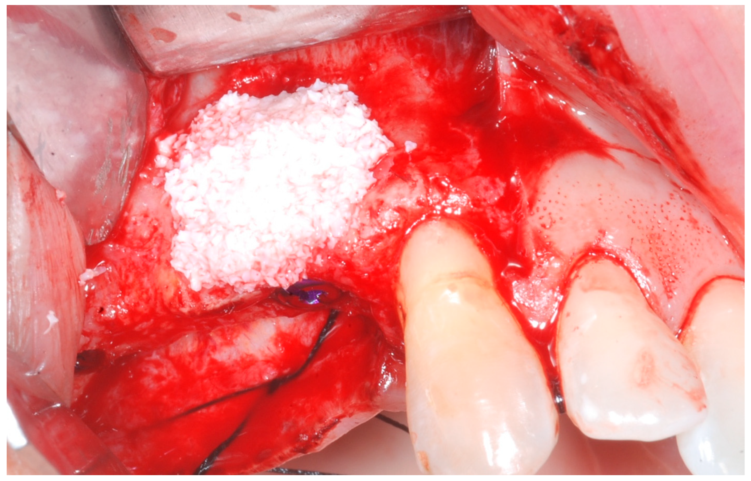 Medicina 61 01814 g005