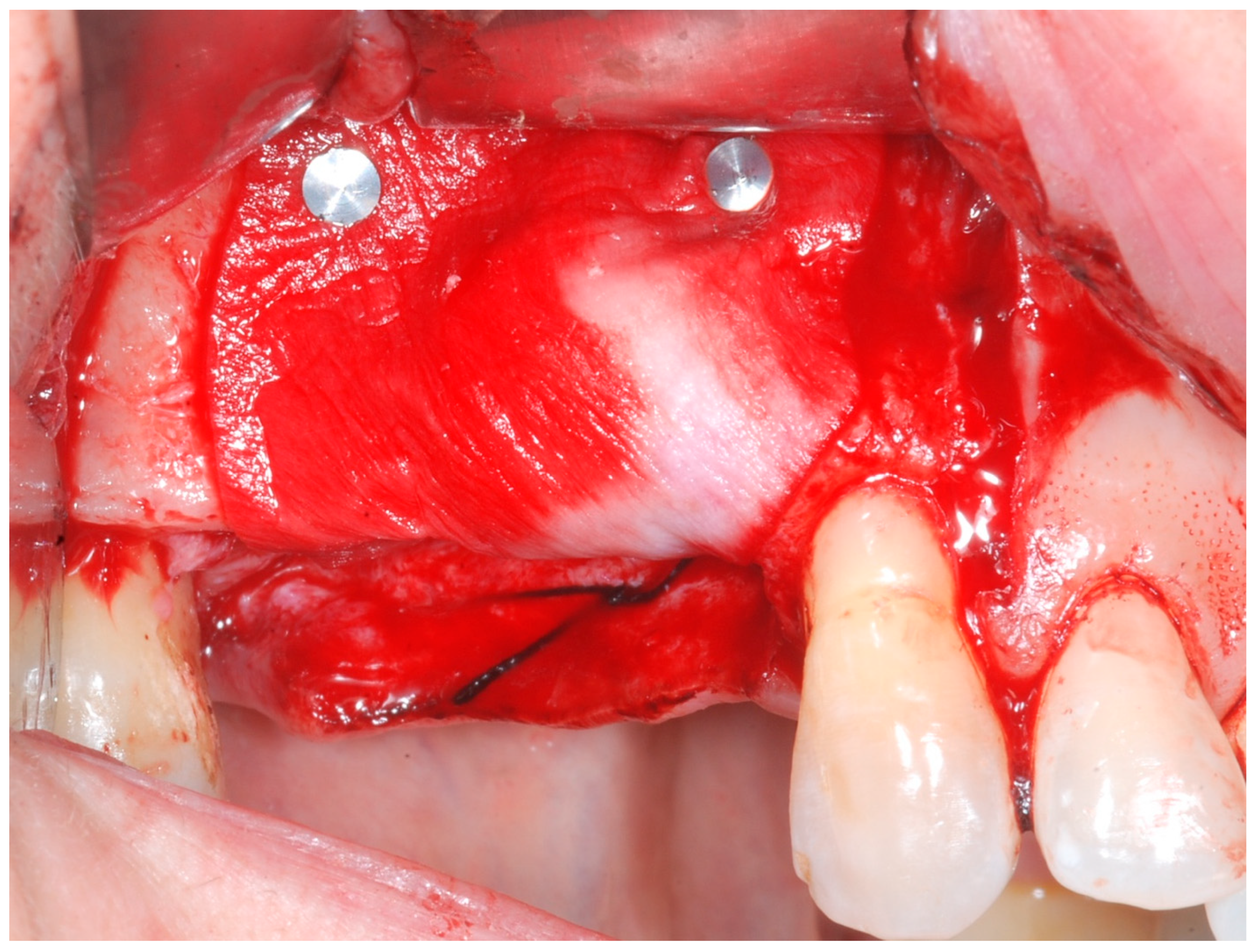 Medicina 61 01814 g006