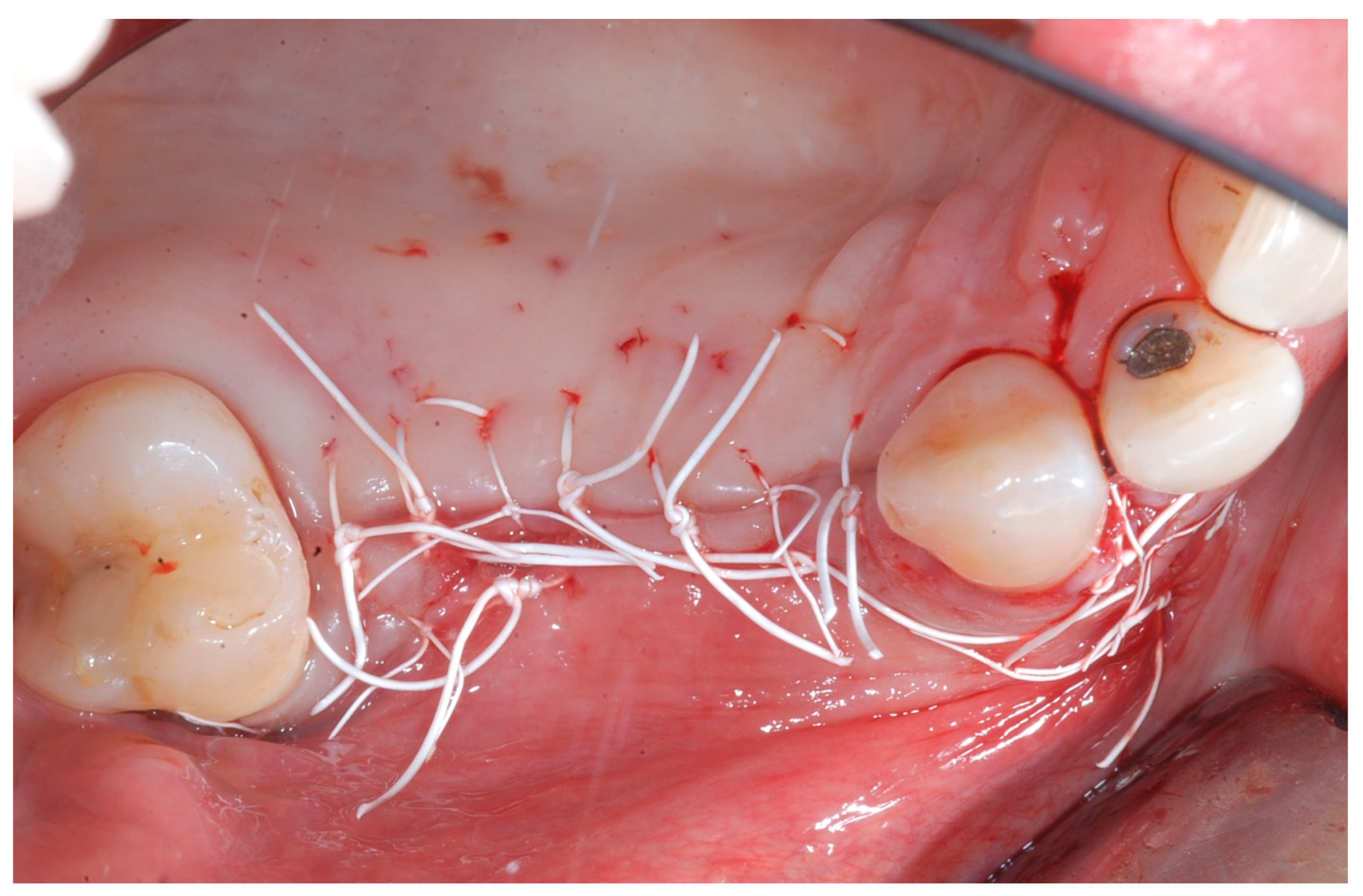 Medicina 61 01814 g007