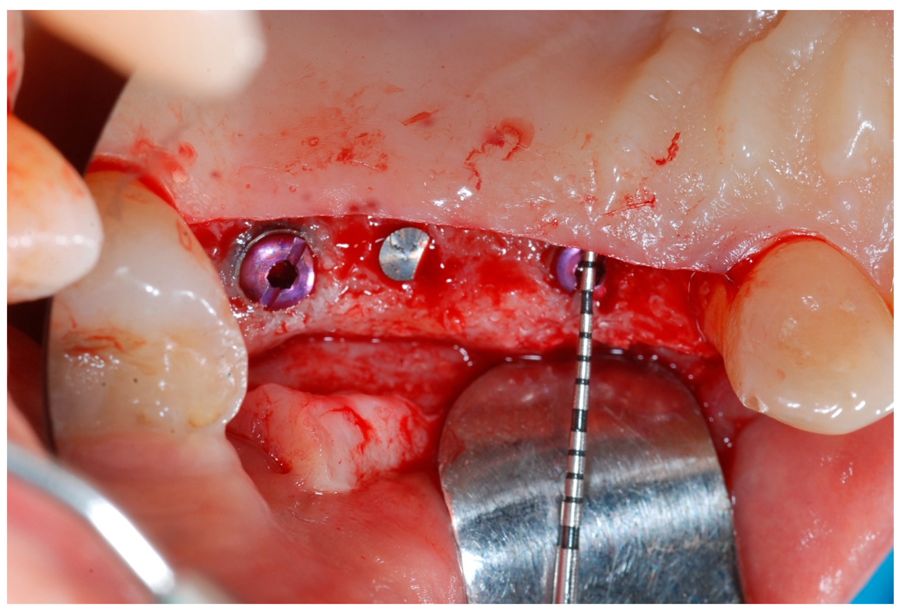 Medicina 61 01814 g009