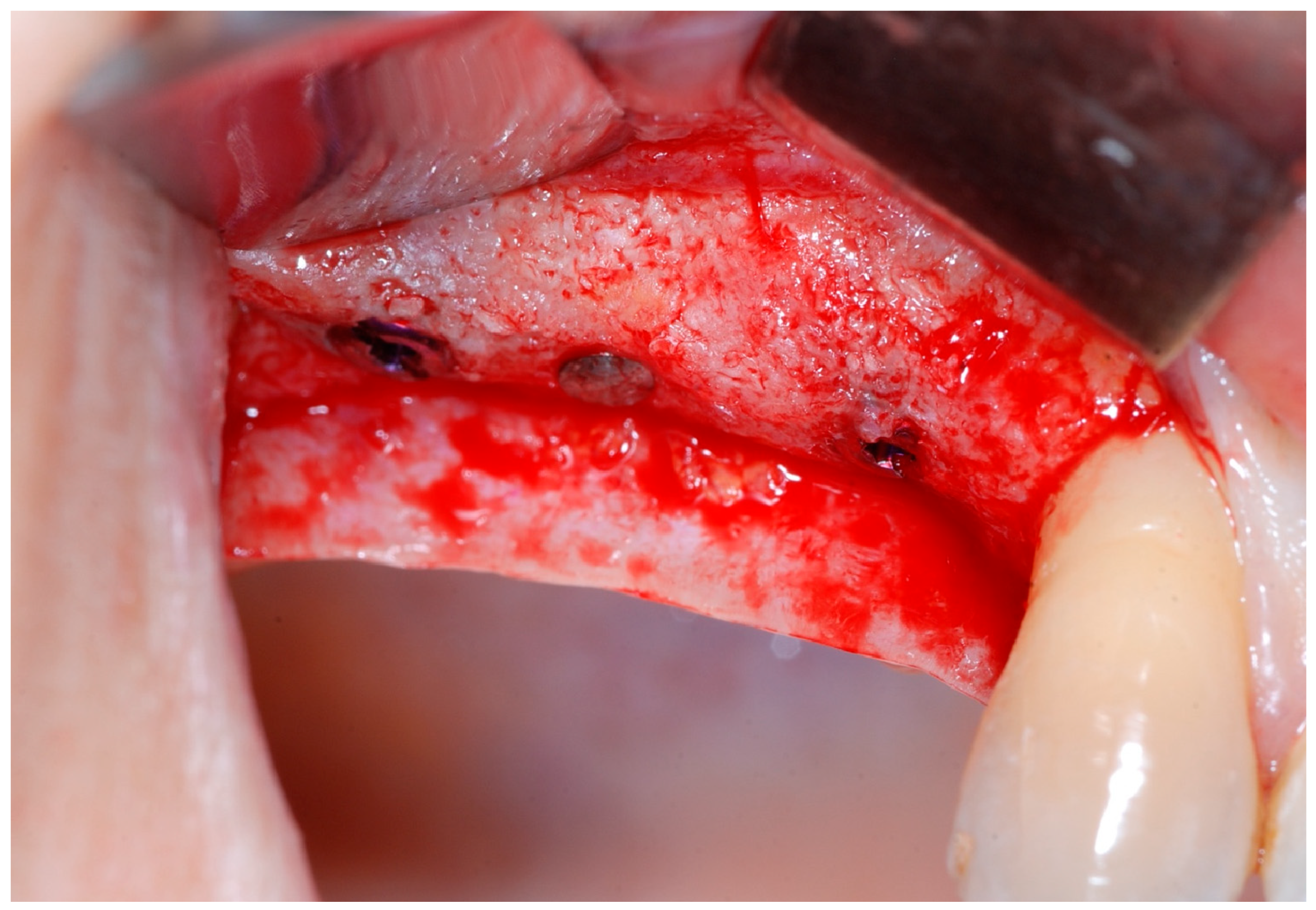 Medicina 61 01814 g010