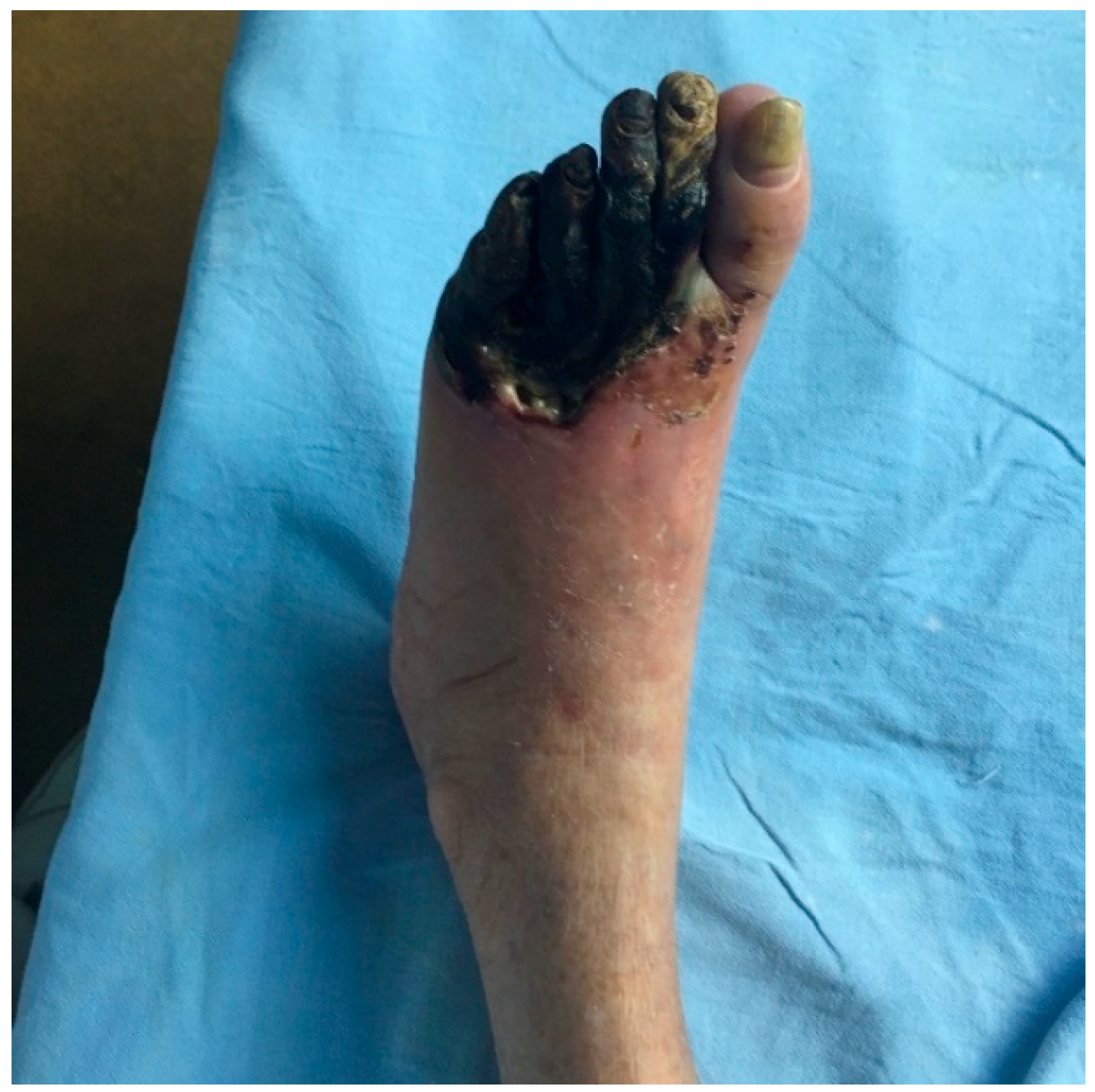 Medicina 61 01817 g002