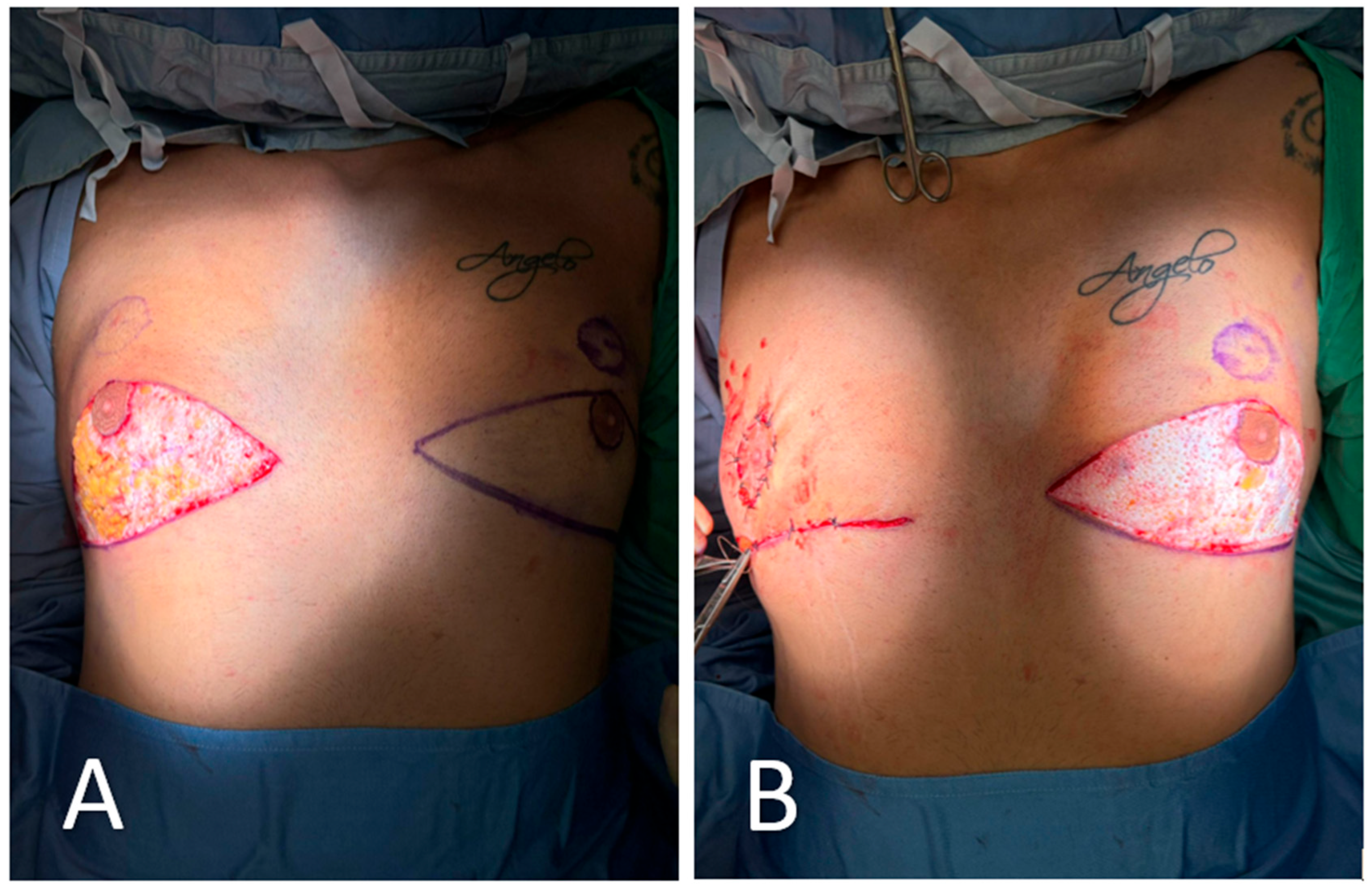 Medicina 61 01842 g002