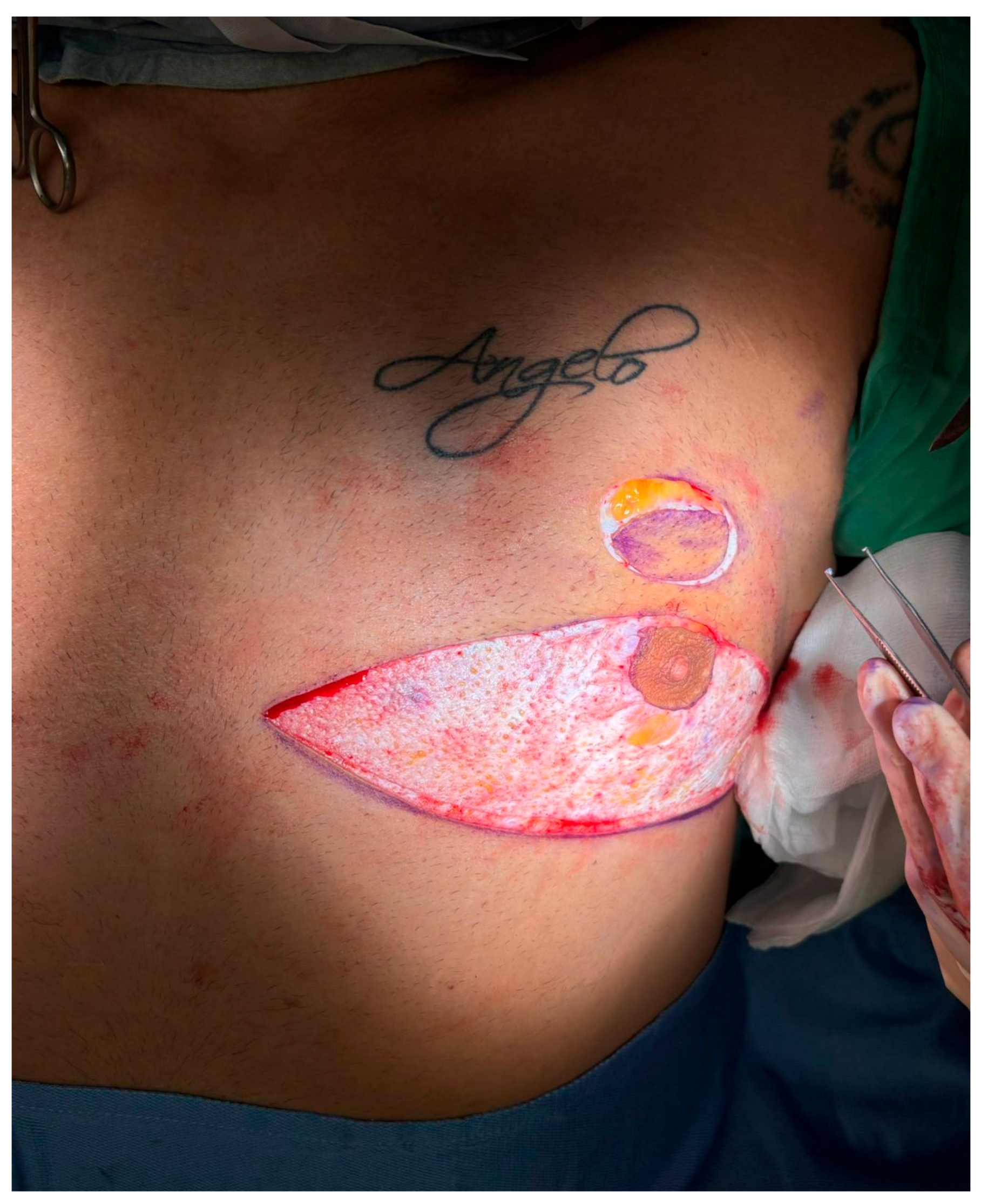 Medicina 61 01842 g003