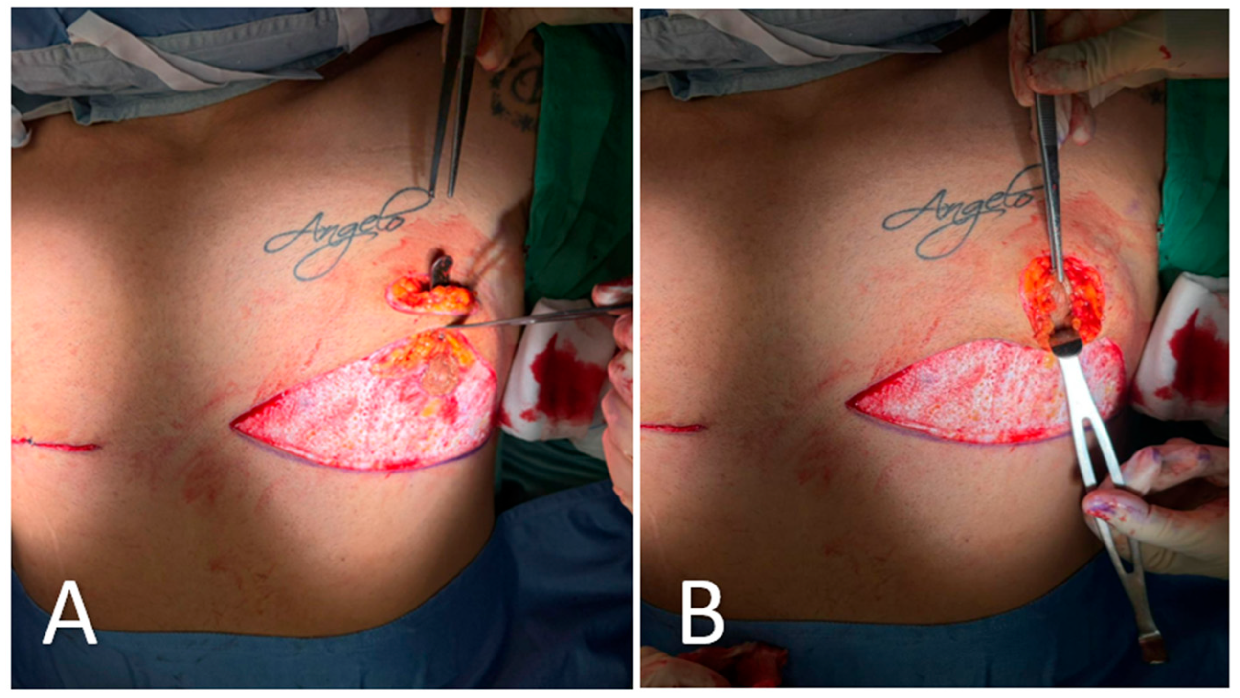 Medicina 61 01842 g004