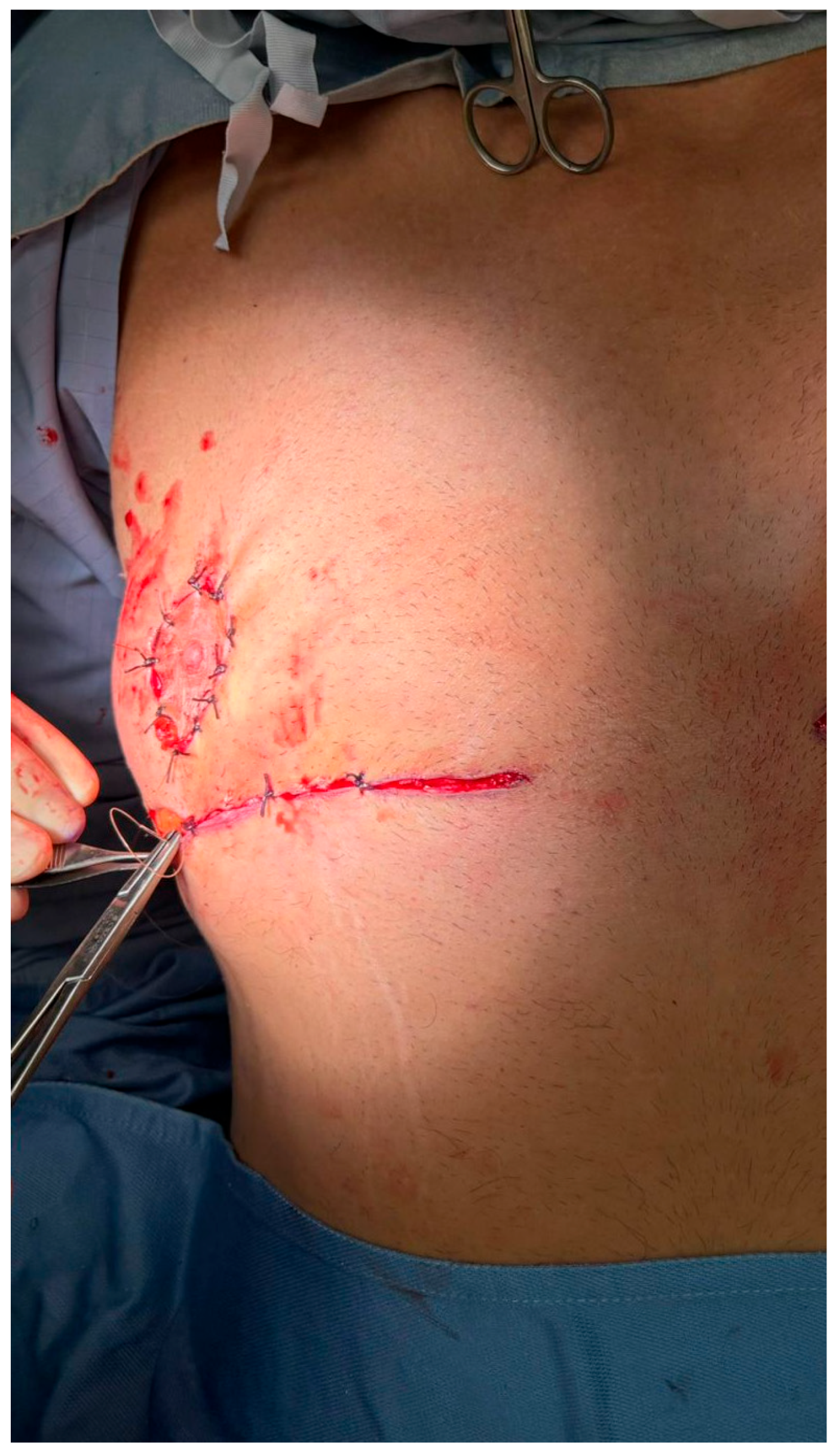 Medicina 61 01842 g005