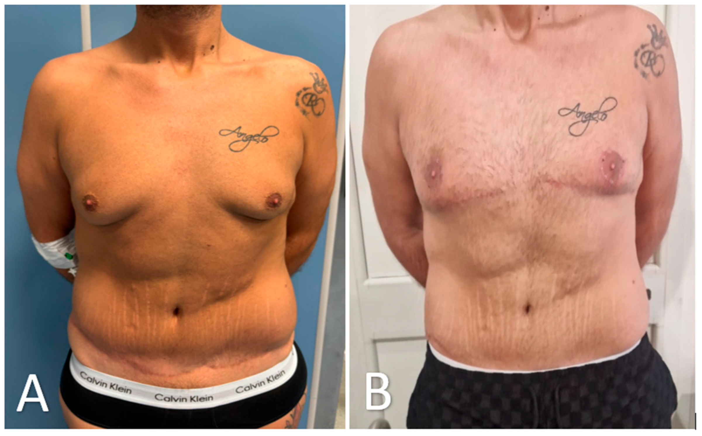 Medicina 61 01842 g007